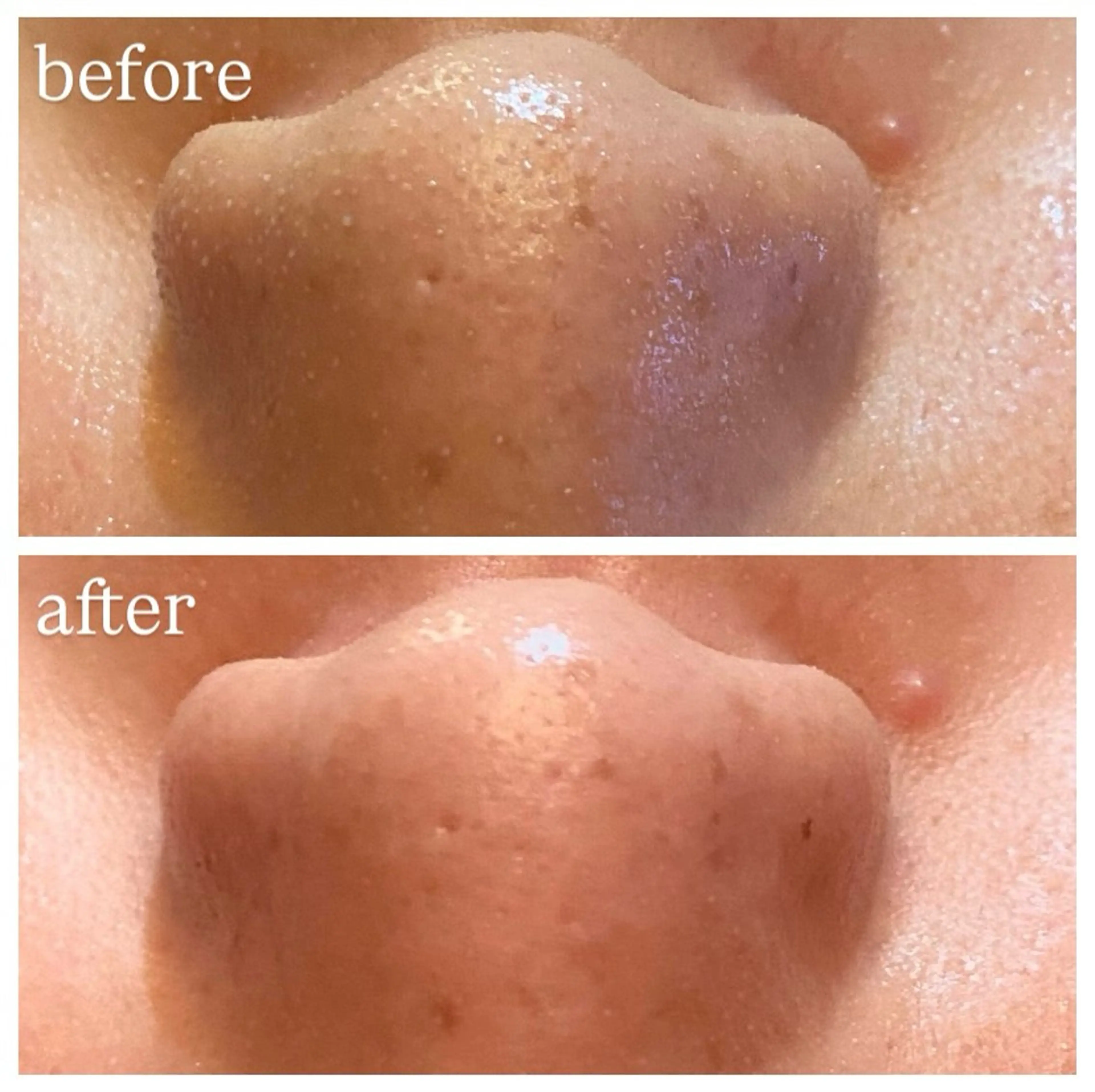 エステ 肌質改善専門 ハーブ /毛穴洗浄 リエイトのエステ・リラクイメージ