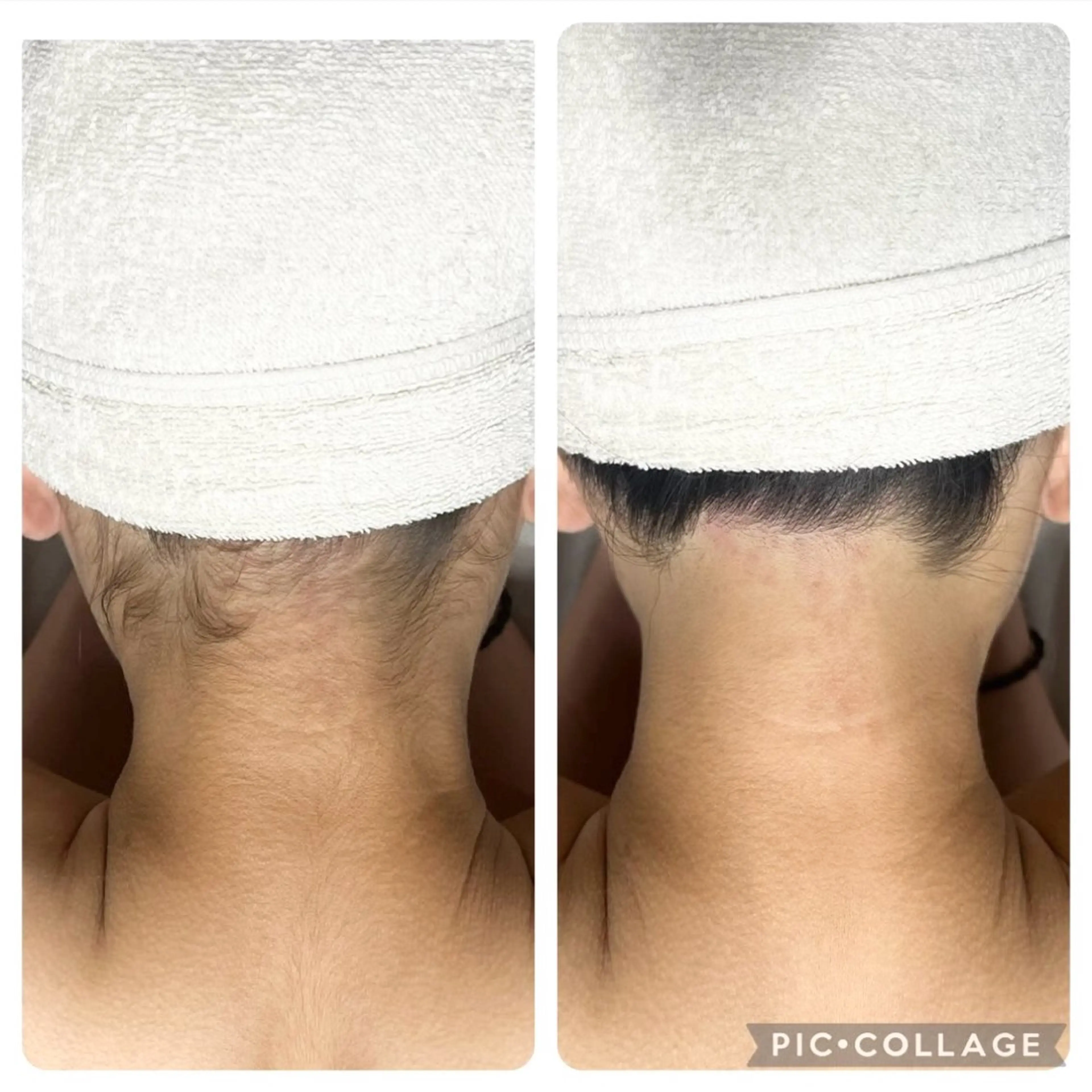 都度払い脱毛サロン Haleのエステ・リラクイメージ