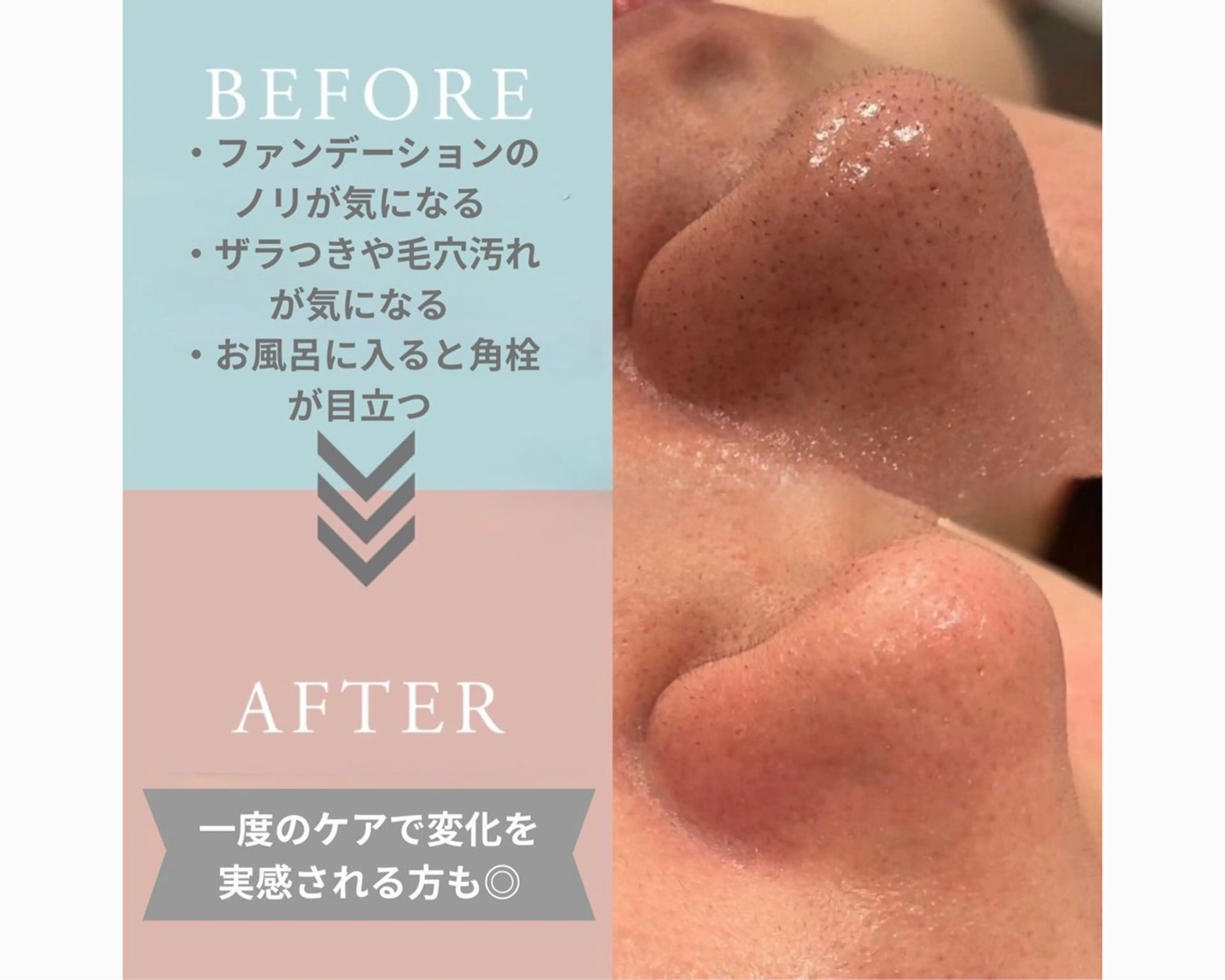 毛穴💧『すっきり洗浄ケア🌀』美容液のトルネード水流でお肌を優しく洗い上げながら、毛穴の奥の汚れをしっかり吸引✨の写真