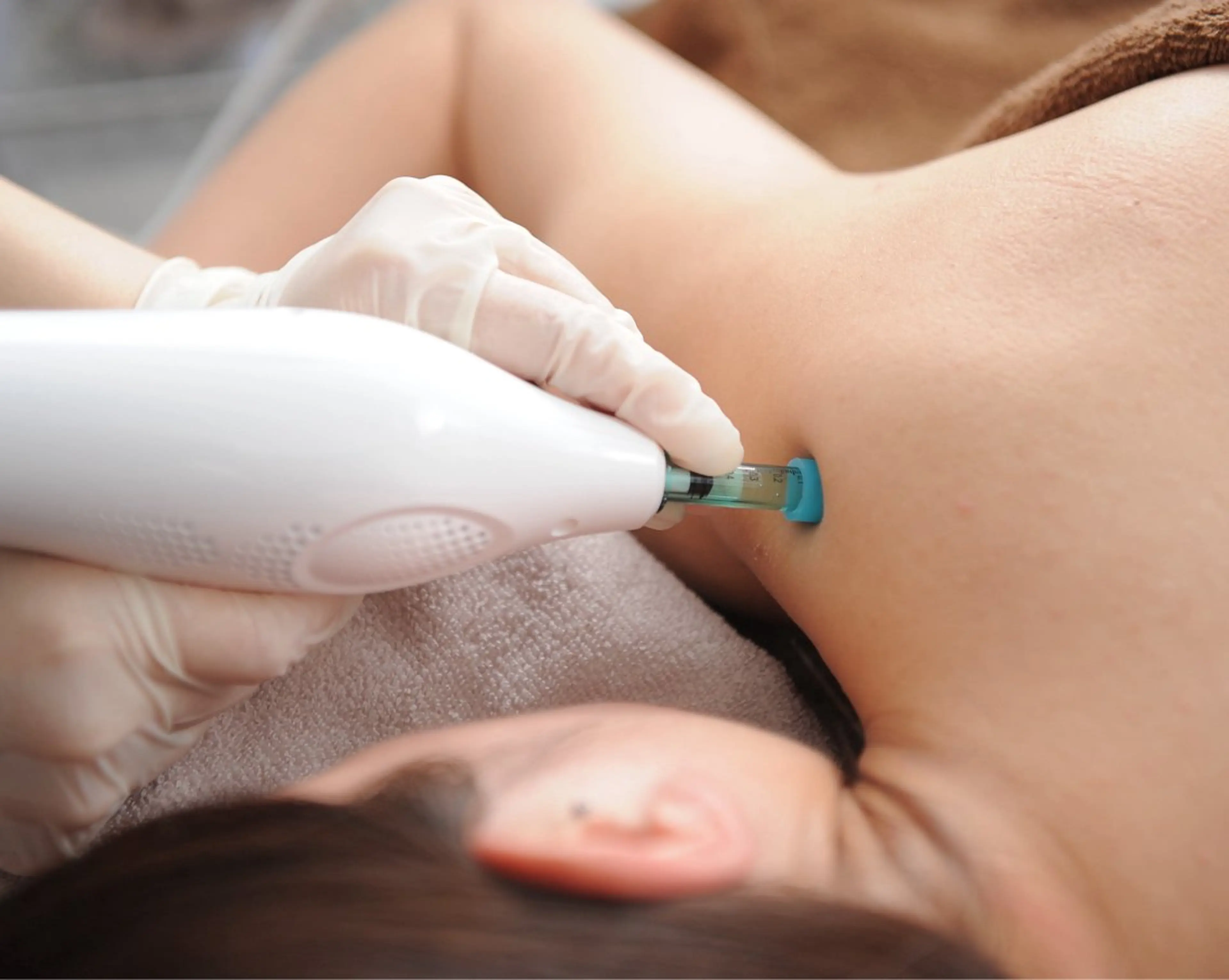 【腰or肩】 選べるペインケア🪐上清液ありの写真