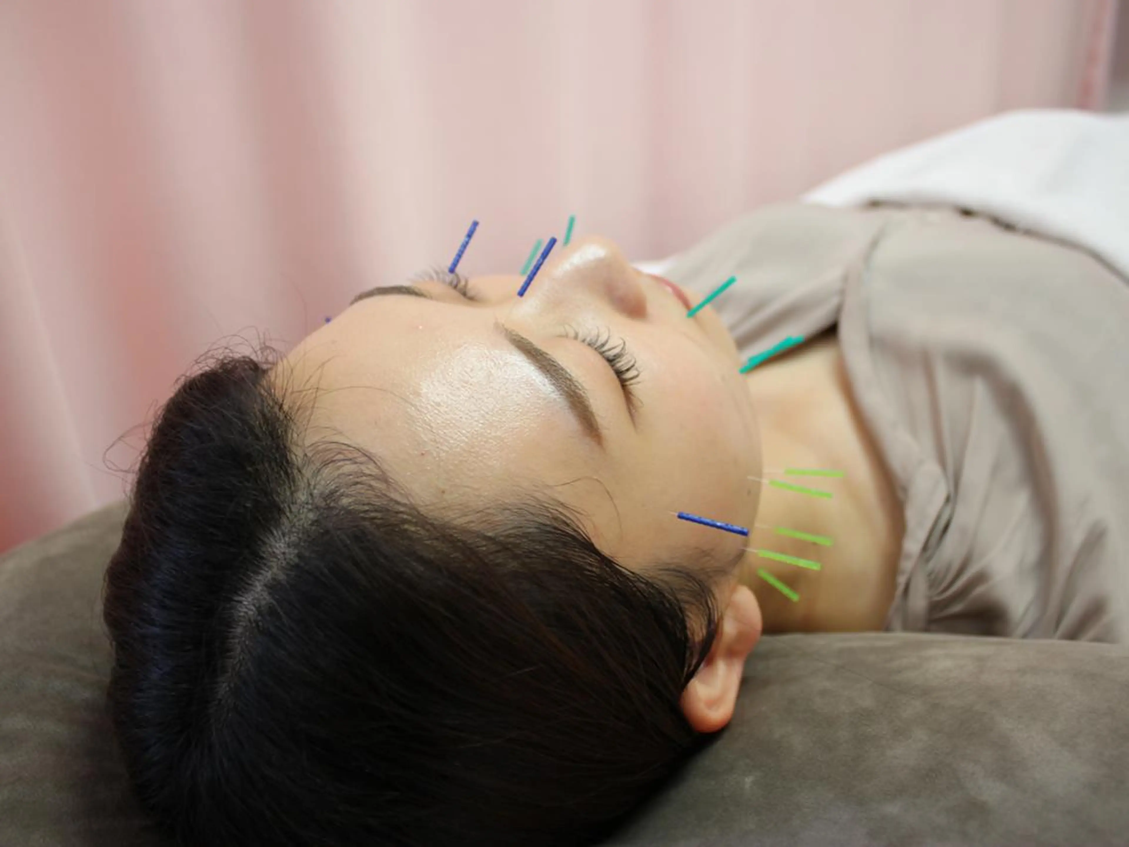 エステ リラク 同心整骨院 美容鍼・整体・小顔のエステ・リラクイメージ