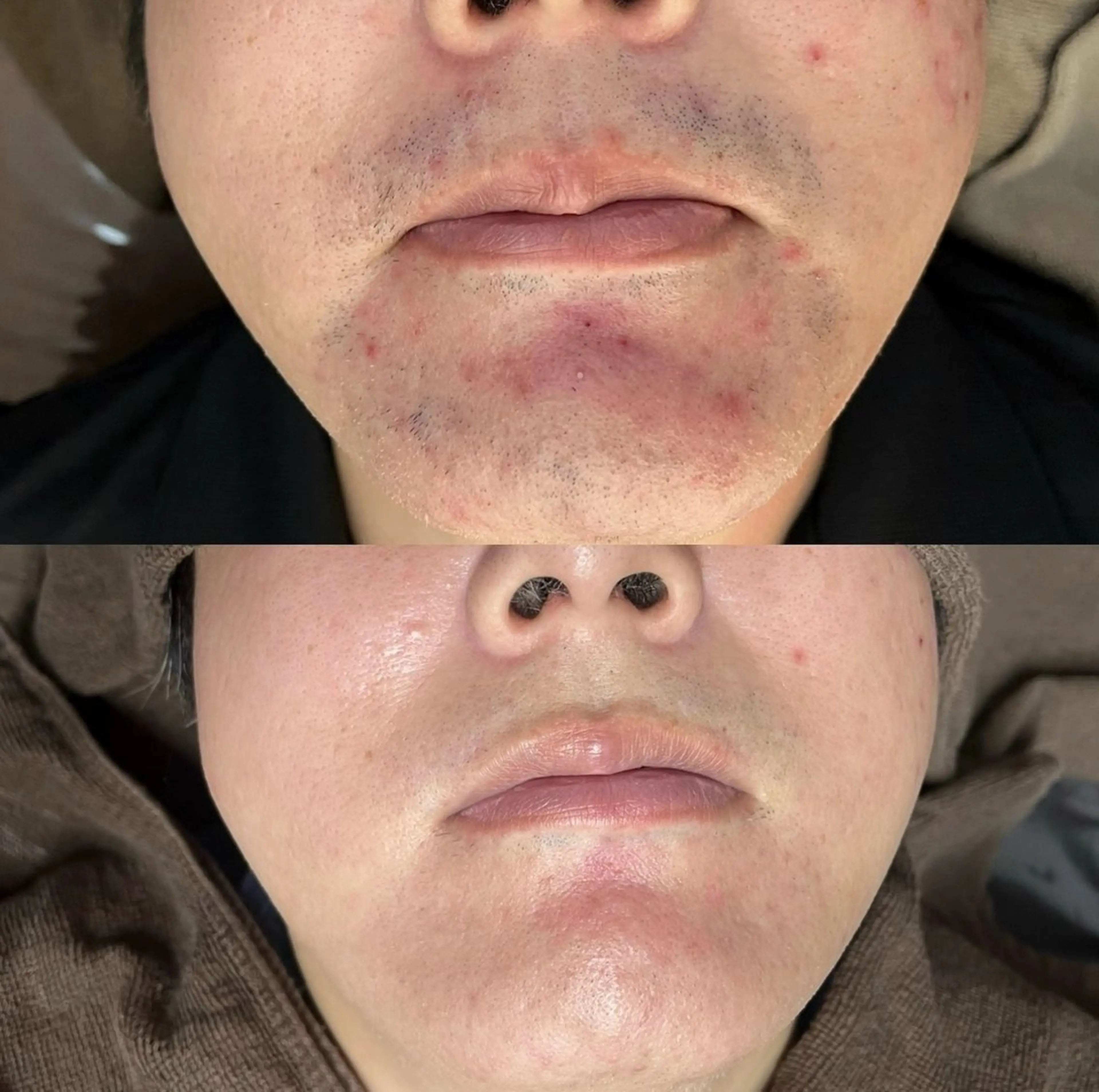 脱毛 Lilyboo 池袋のエステ・リラクイメージ