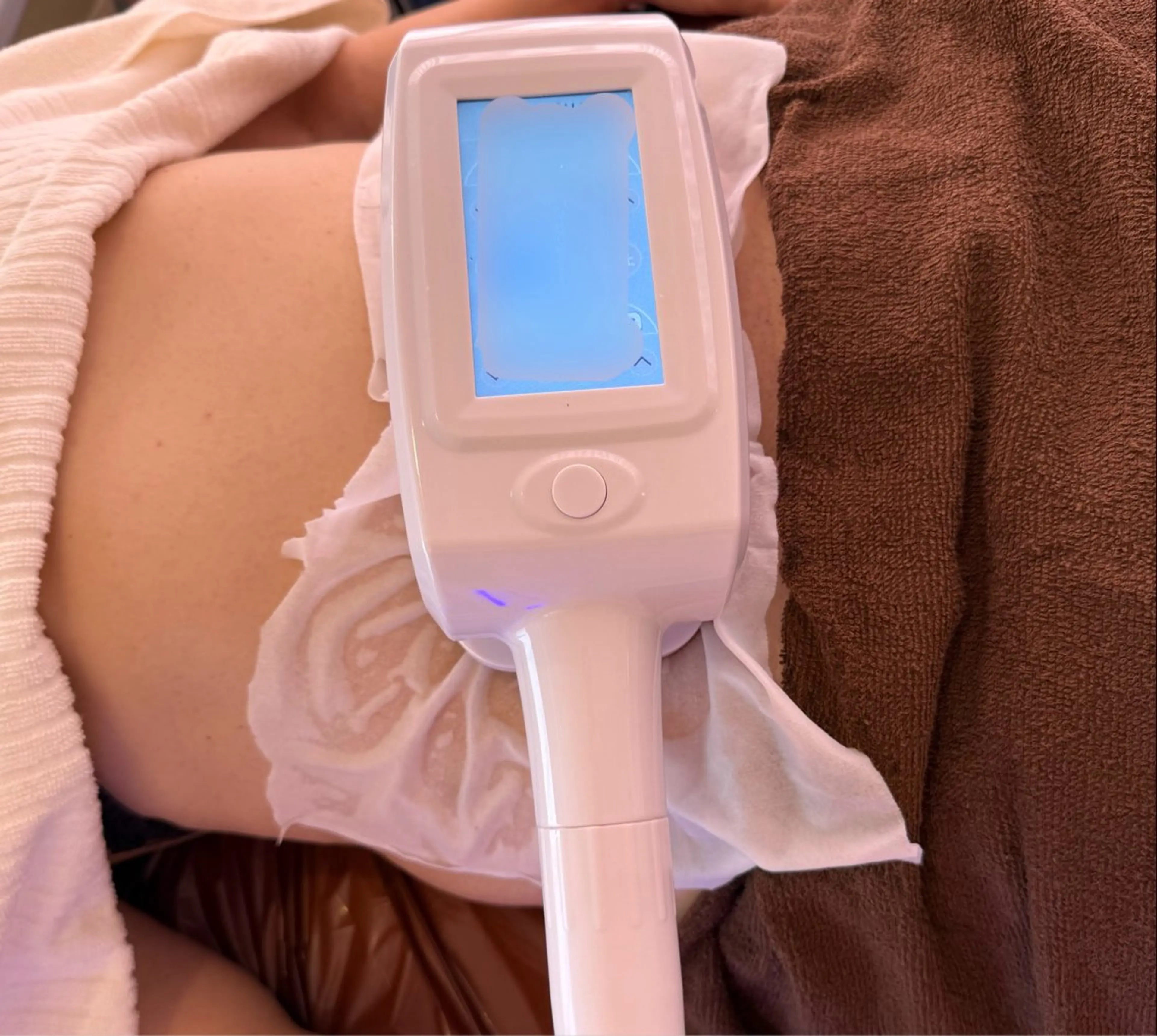 【移転Open価格】4月限定✨冷却痩身1カップの写真