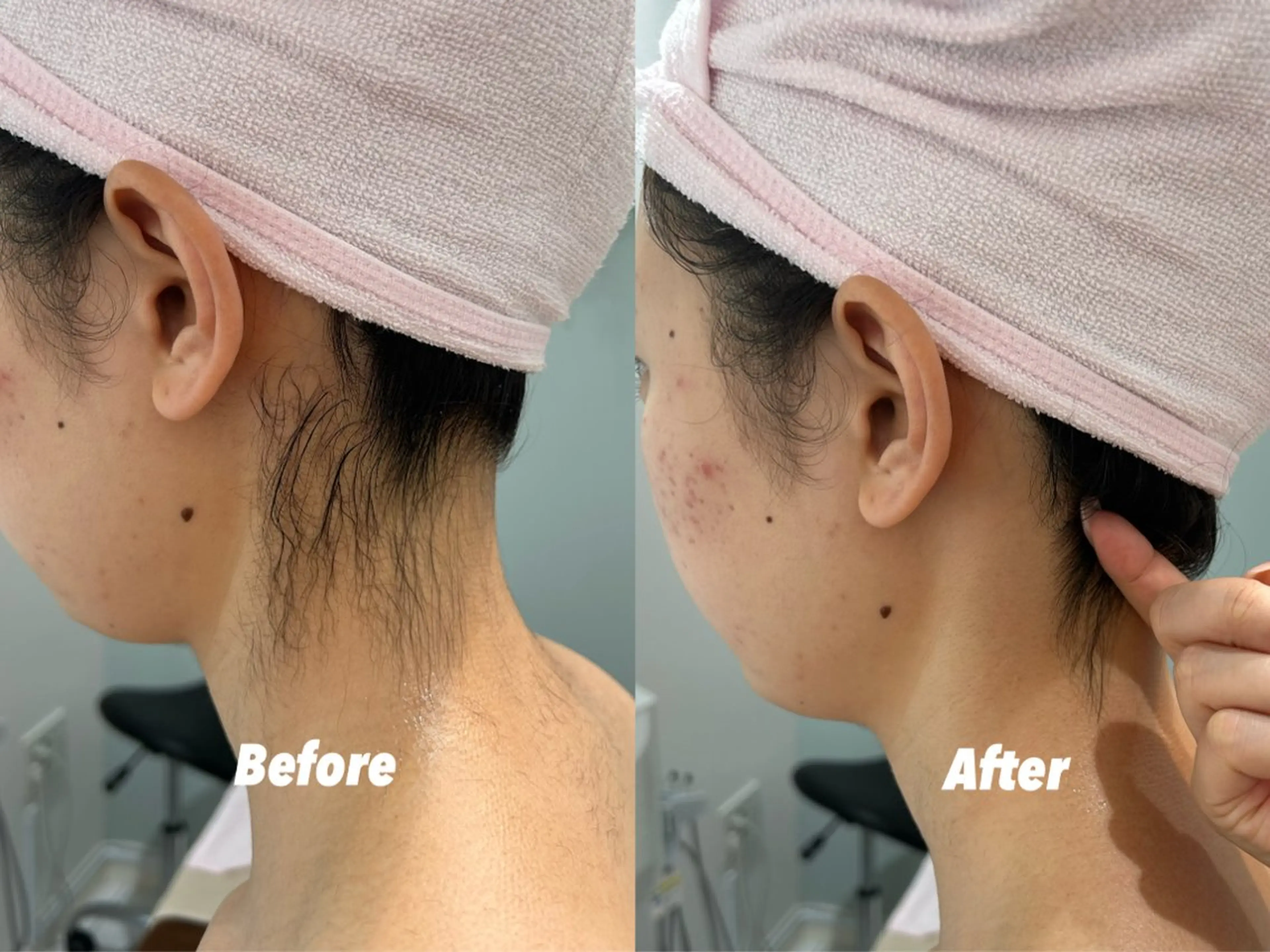 エステ リラク 🫧美しい素肌へ🫧 今成柚乃のその他イメージ