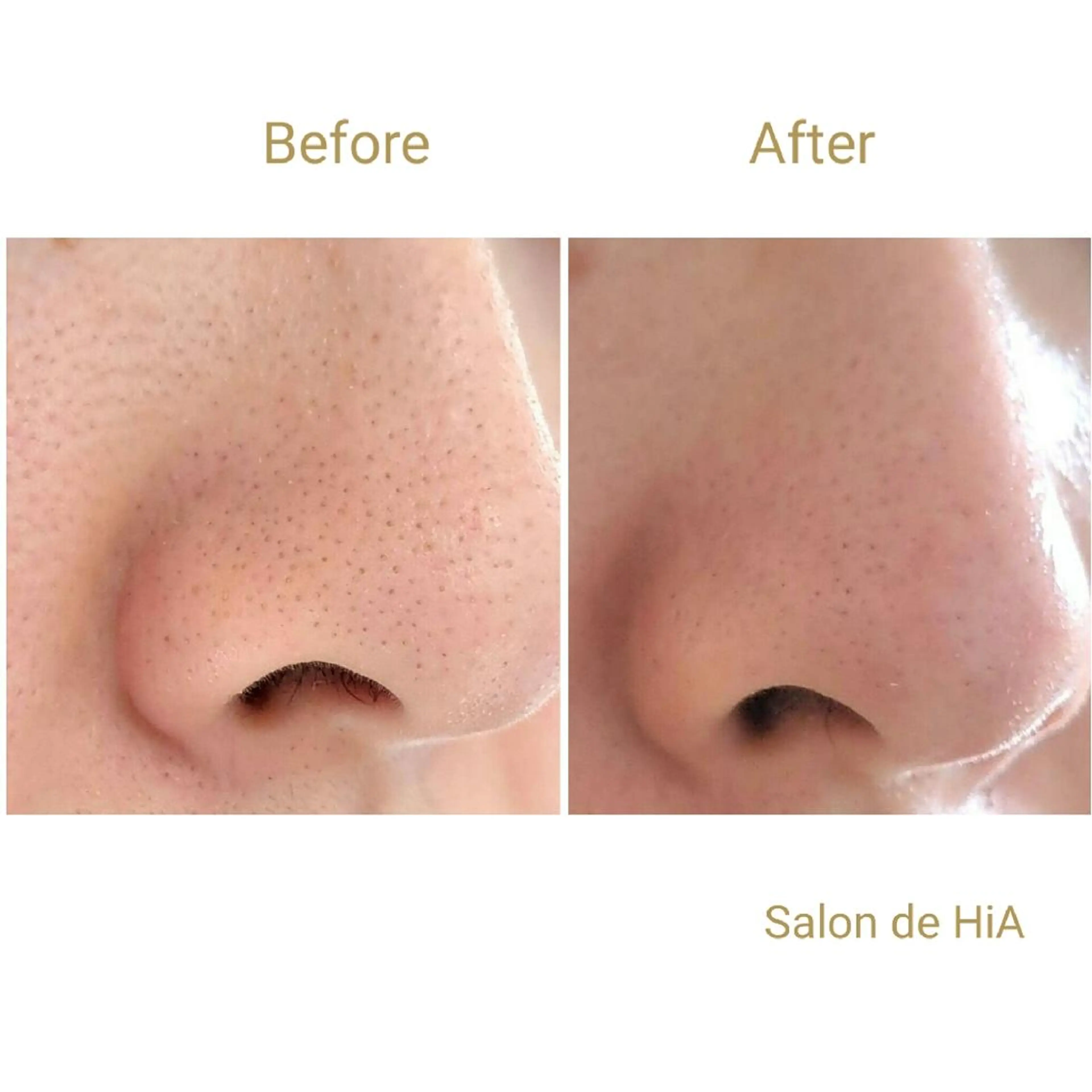 エステ Salon de  HiAのエステ・リラクイメージ