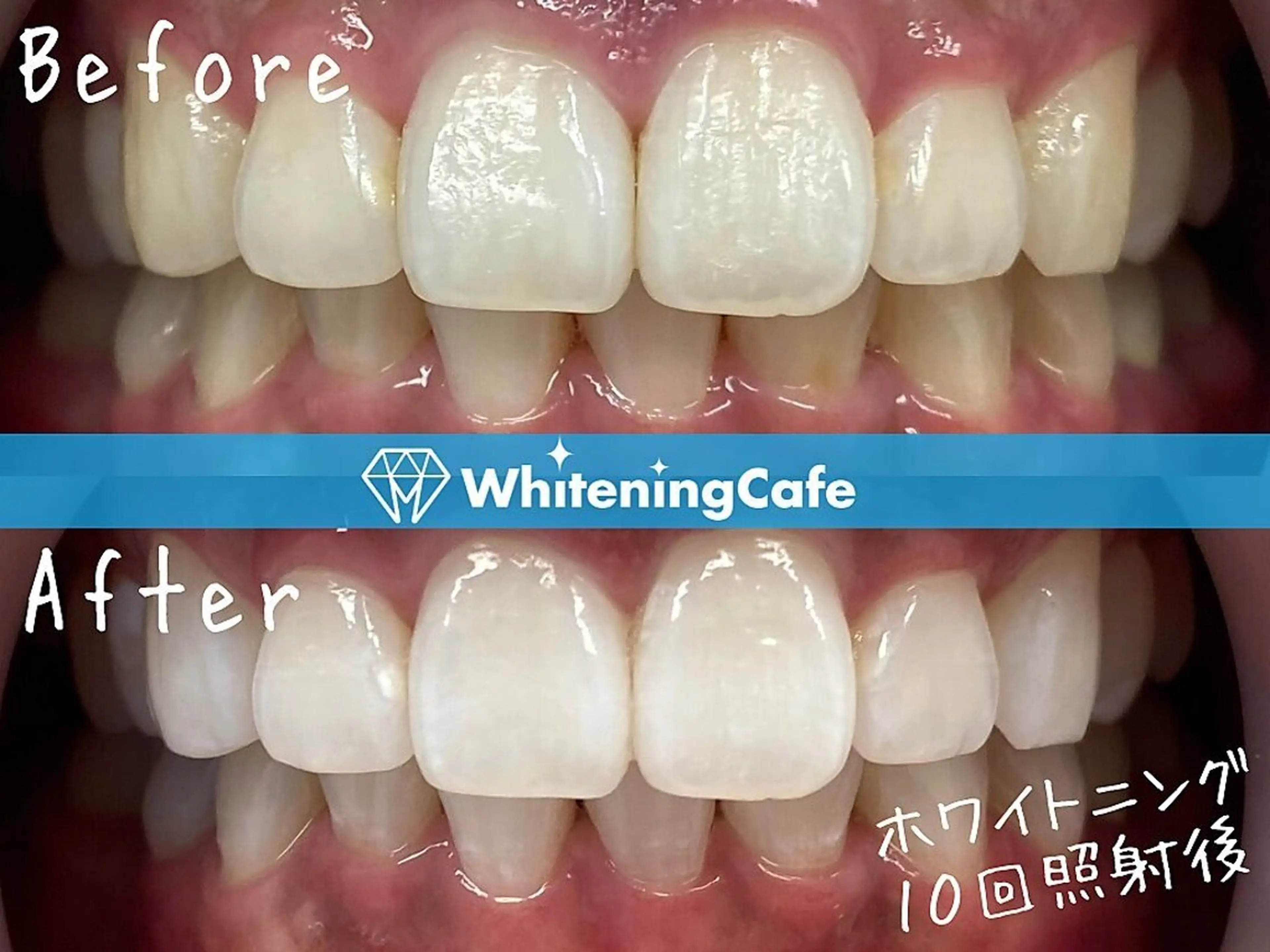 ホワイトニングカフェ 中野店のその他イメージ