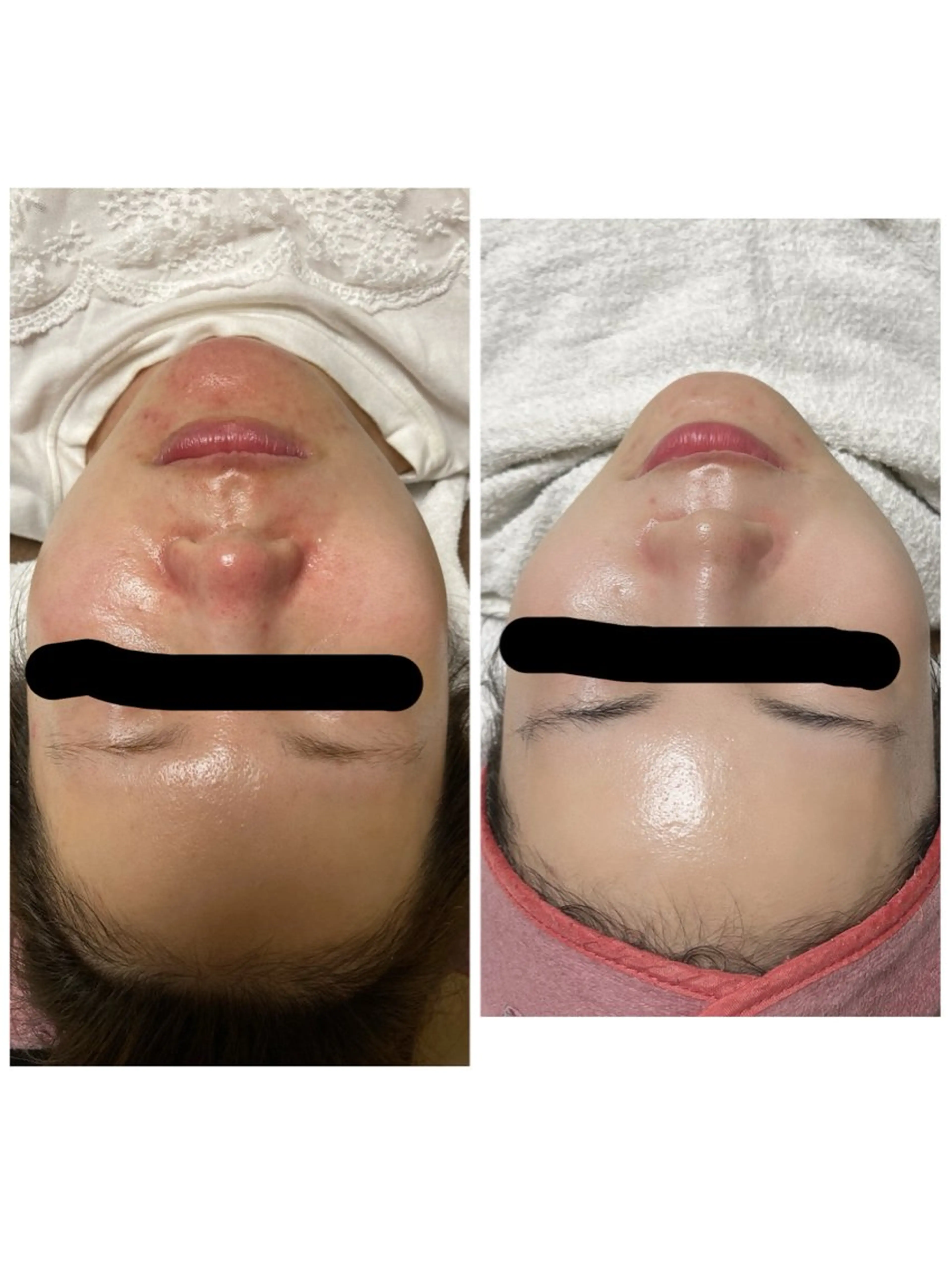 トータルエステサロン Tiaraのエステ・リラクイメージ