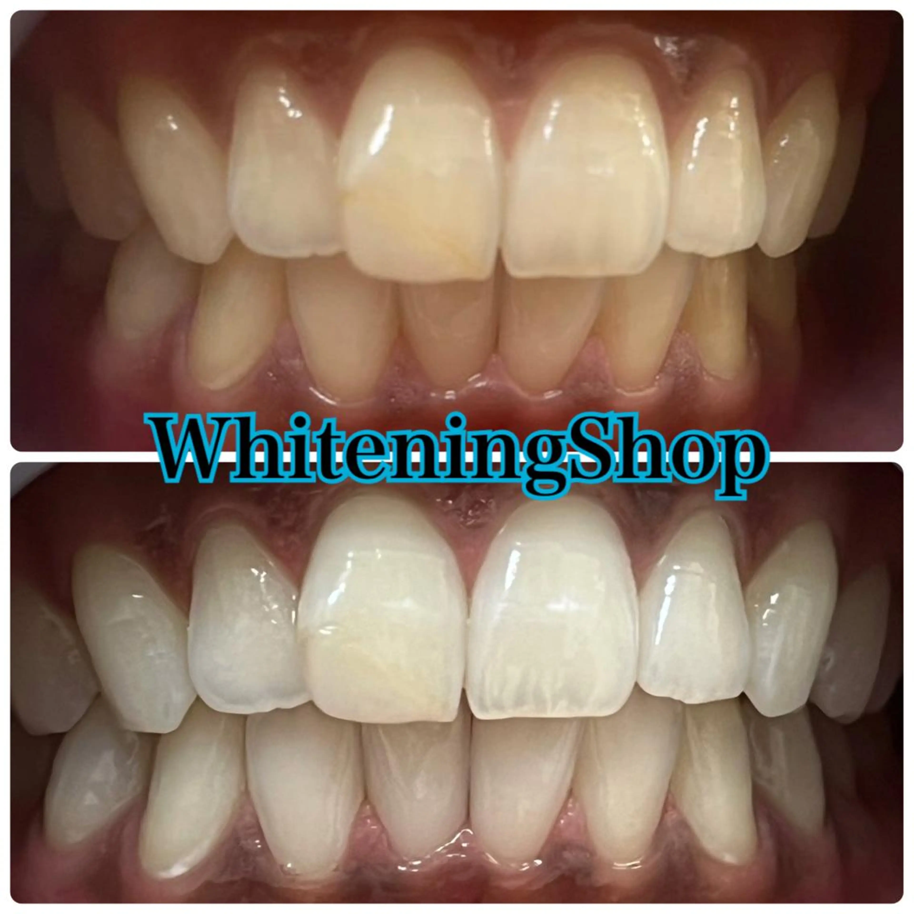 ホワイトニング ショップ吉祥寺店のエステ・リラクイメージ