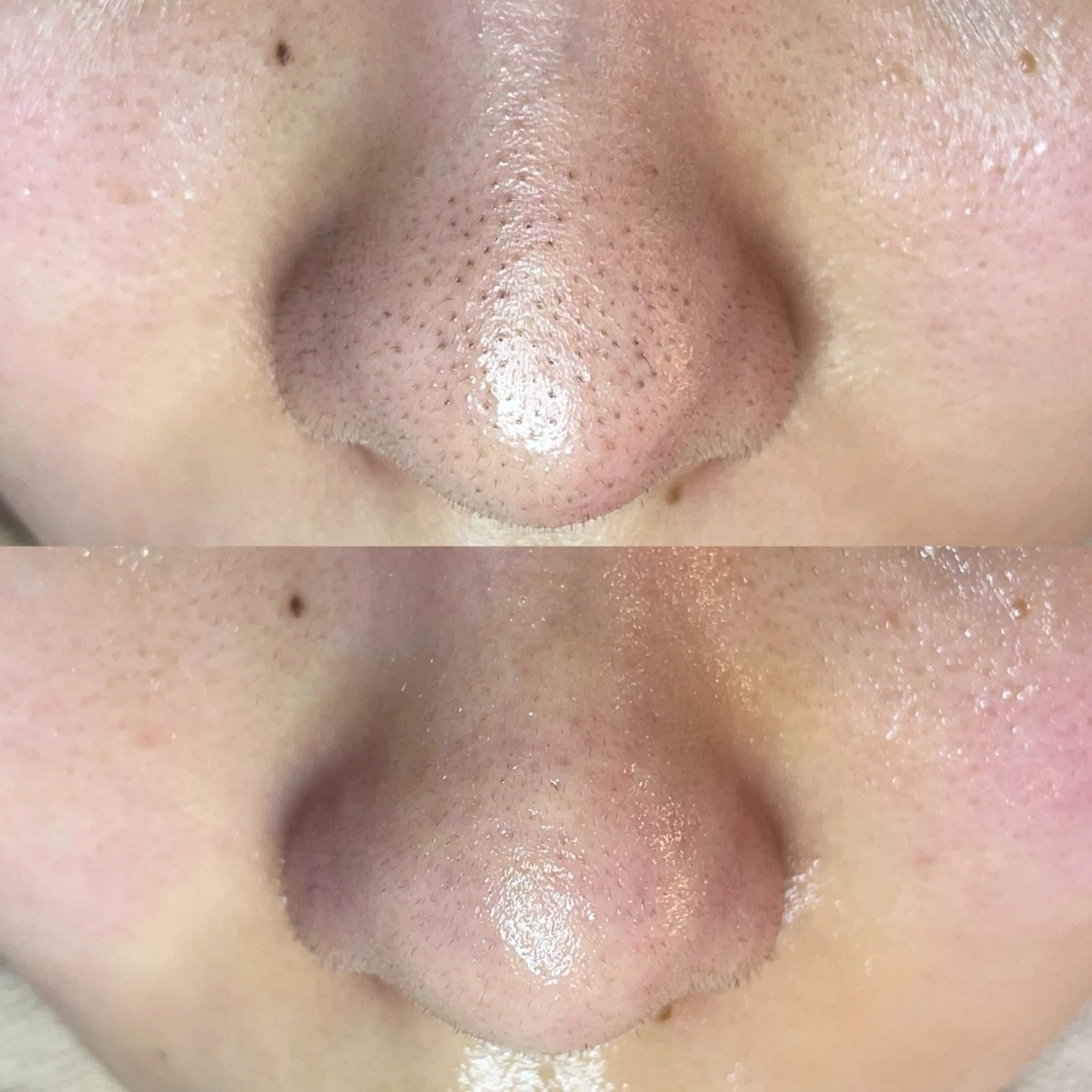 毛穴・頭皮 専門店💪のその他イメージ