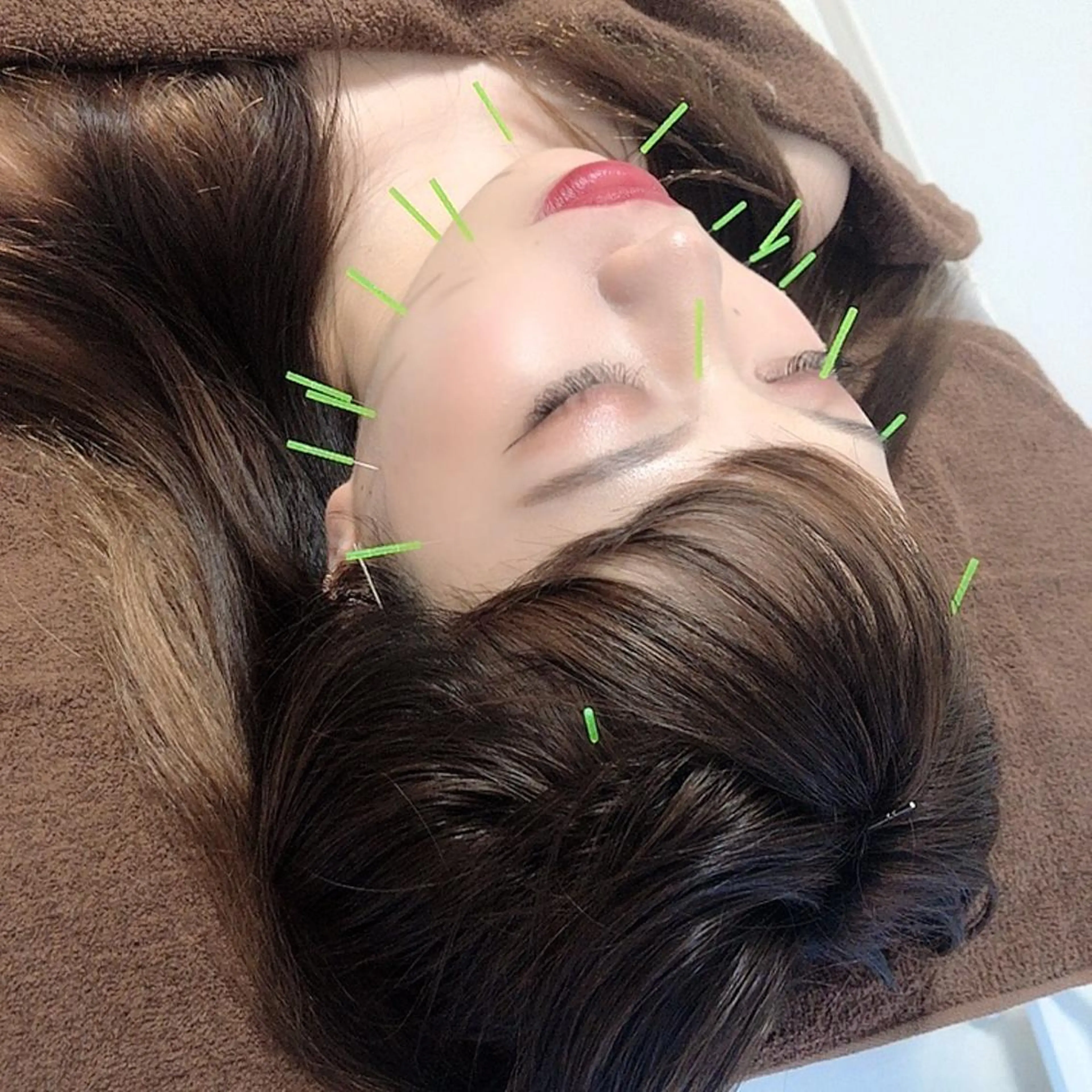 心斎橋痩身ダイエット 韓国.美容鍼.小顔のエステ・リラクイメージ