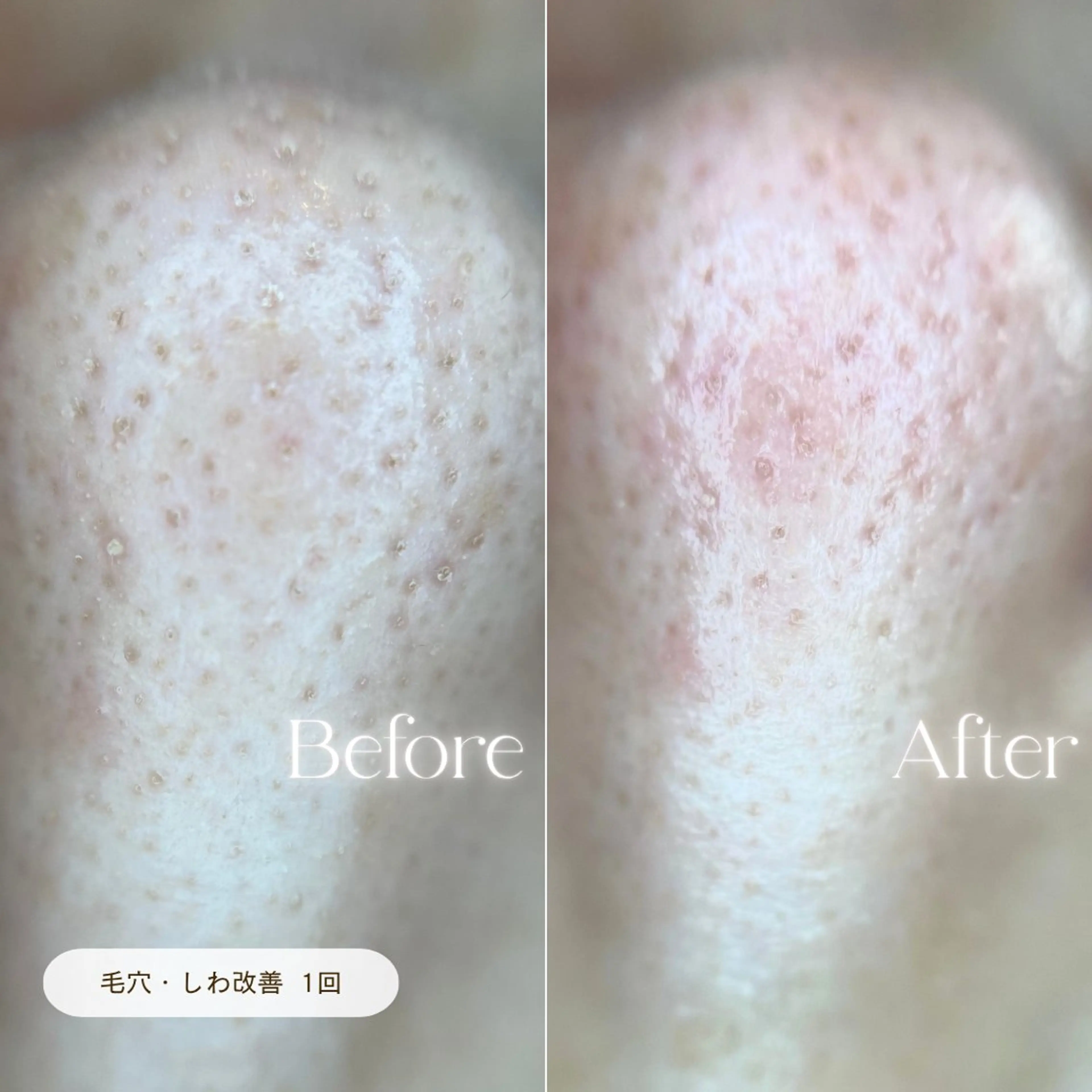 エステ リラク CURATED SKIN｜神戸三宮のエステ・リラクイメージ