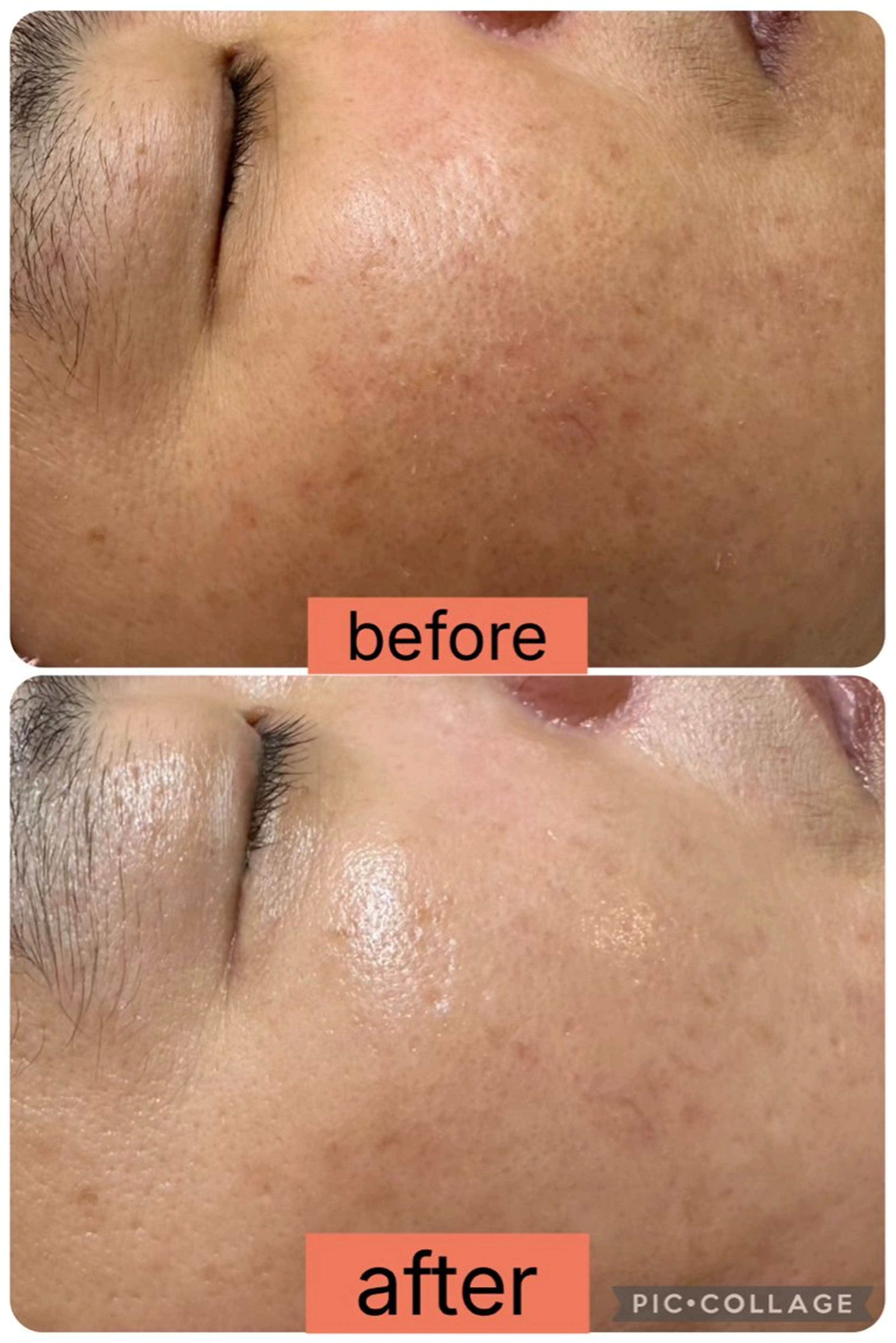 エステ EPIL 宮本のエステ・リラクイメージ