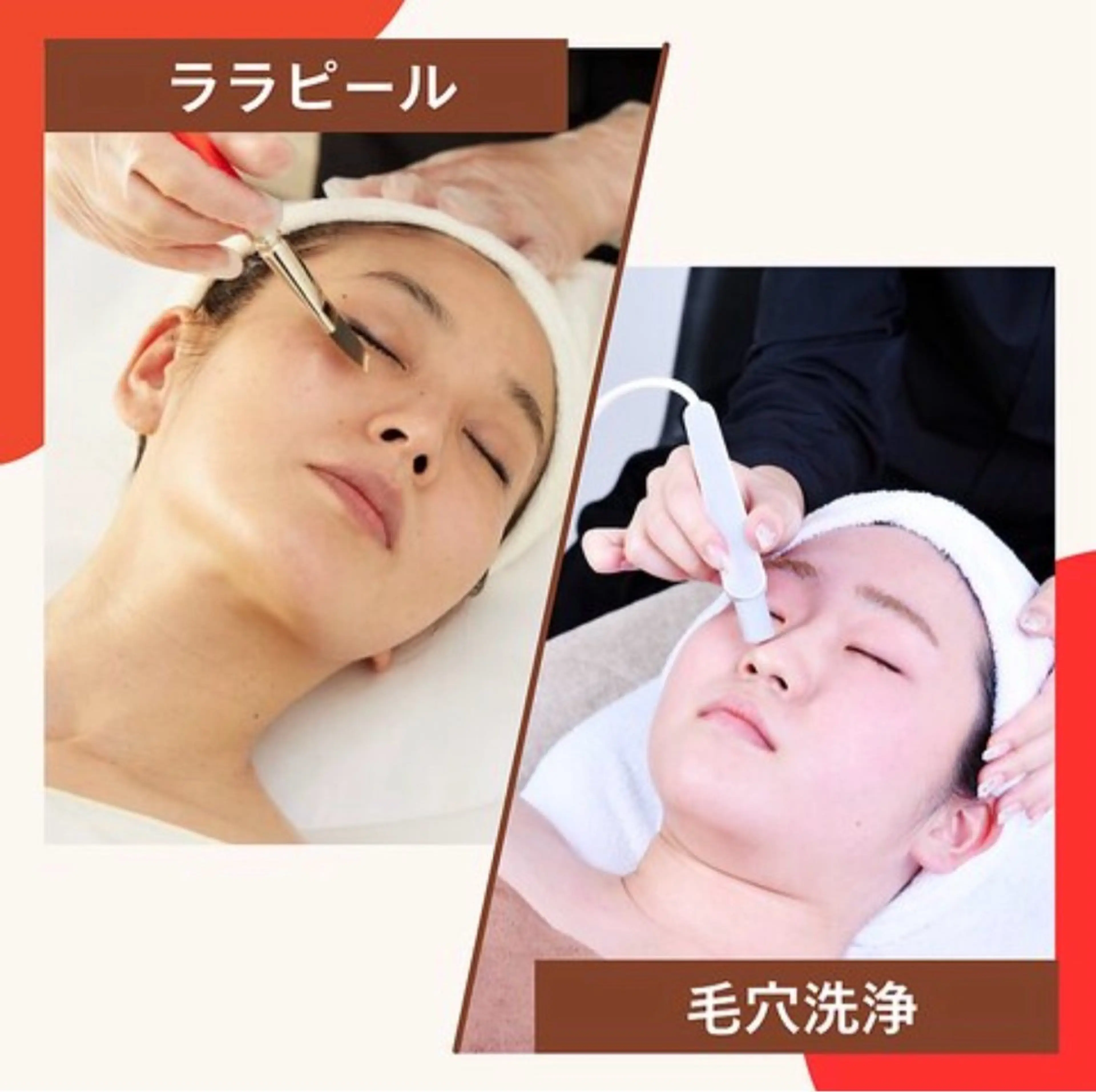 【徹底毛穴ケア！即うるツヤ肌に🩵】ララピール+毛穴洗浄（全顔）の写真