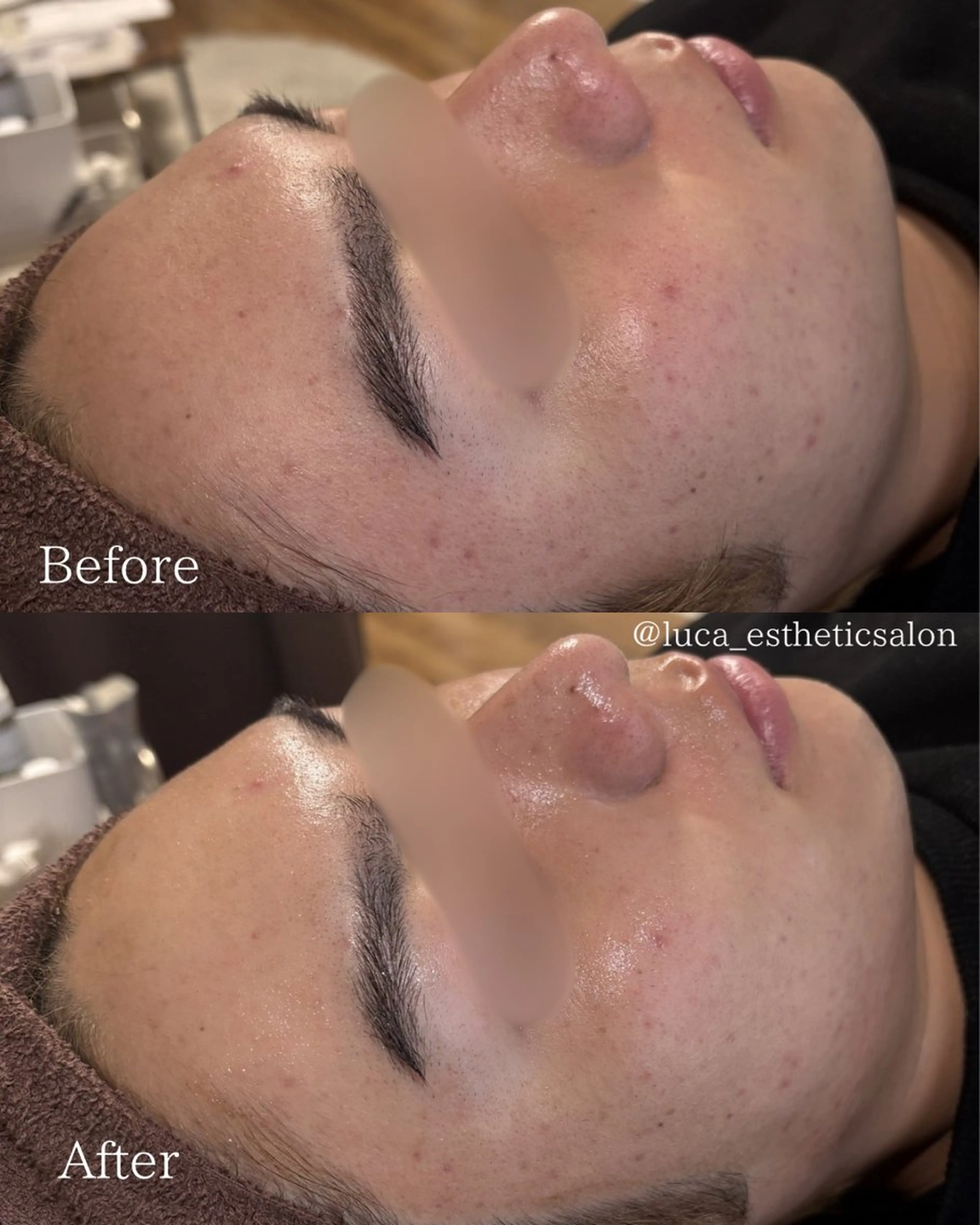 エステ Luca 痩身• 疲労改善×韓国肌管理のエステ・リラクイメージ