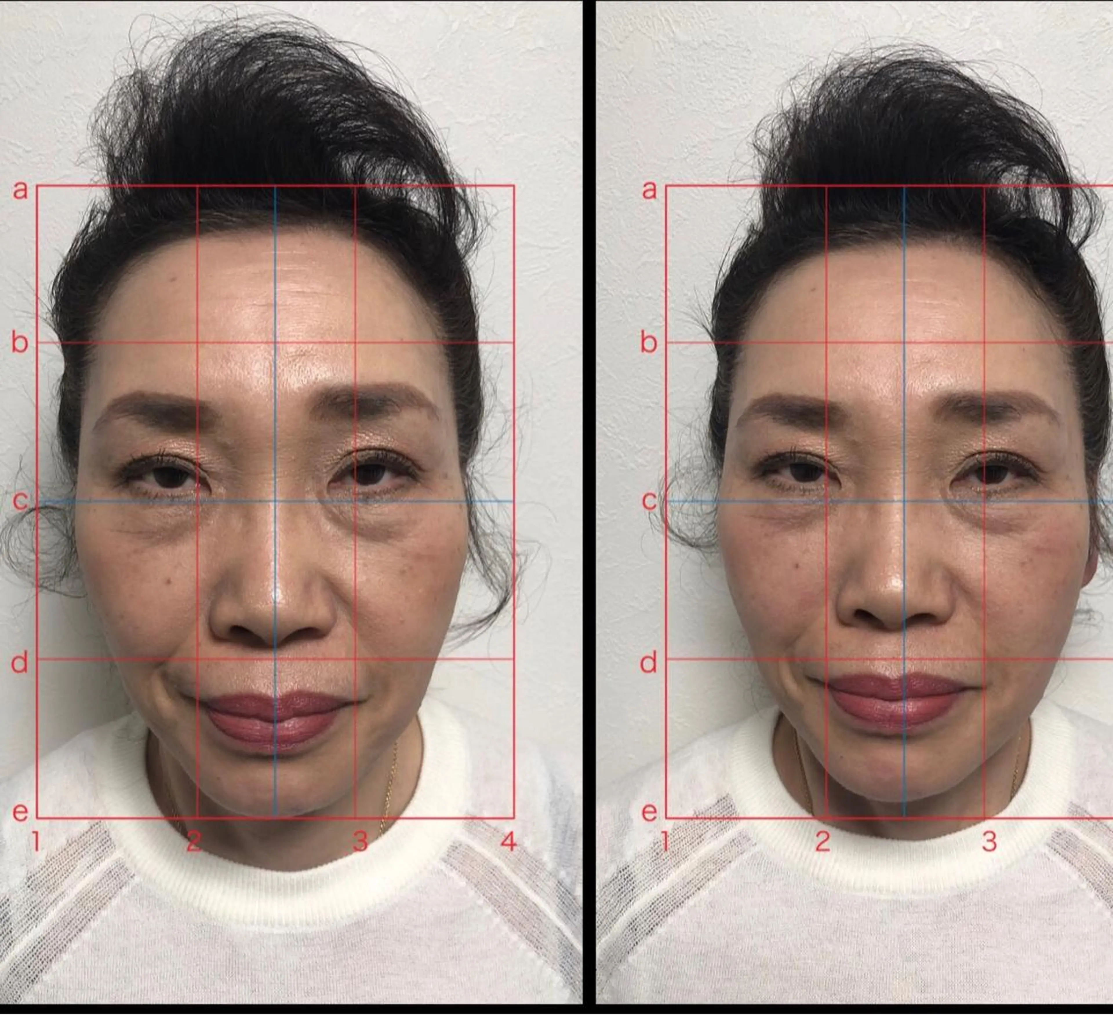 エステ リラク やはた 鍼灸整骨院のエステ・リラクイメージ