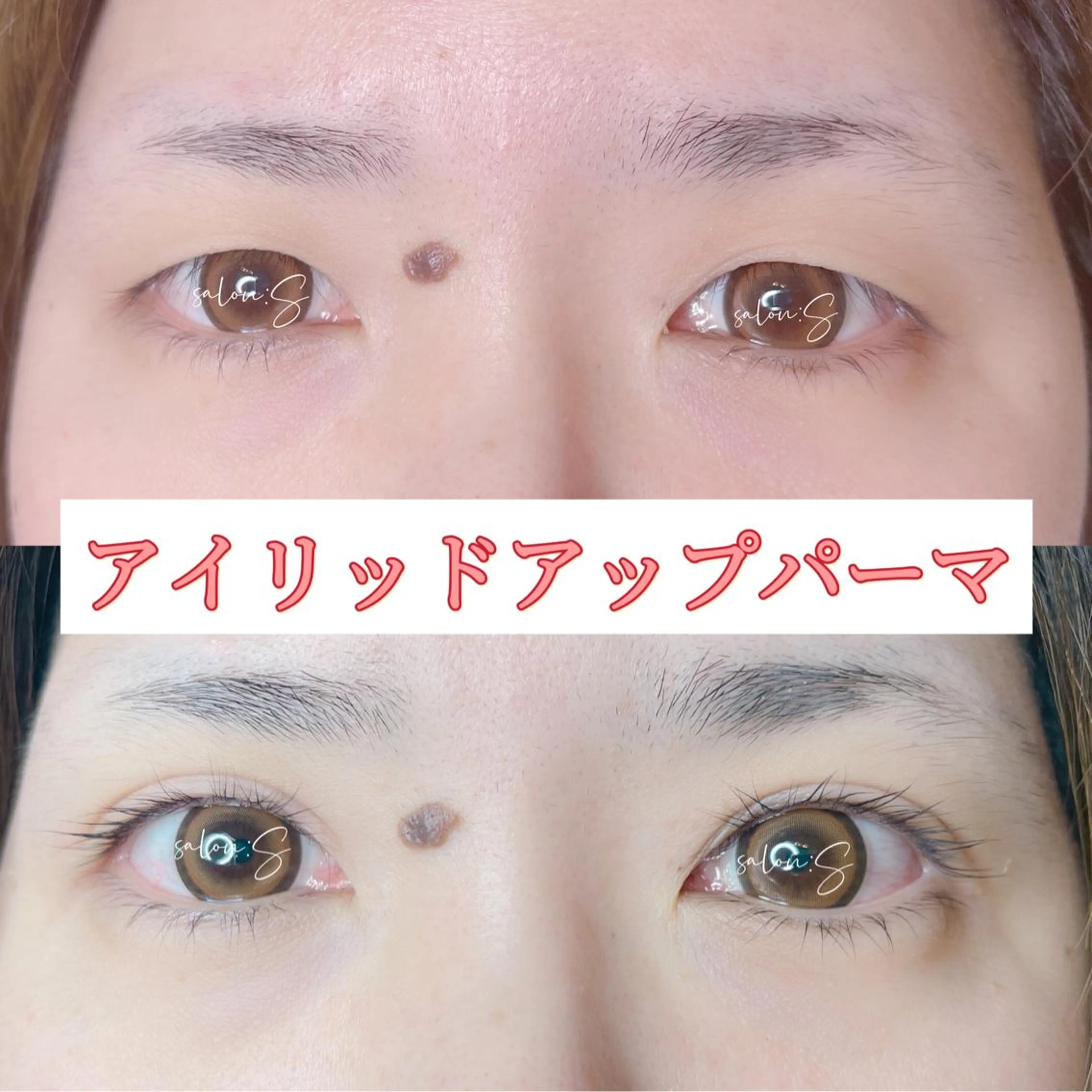 【仙台初】アイリッドアップパーマ（瞼引き上げマツパ）の写真