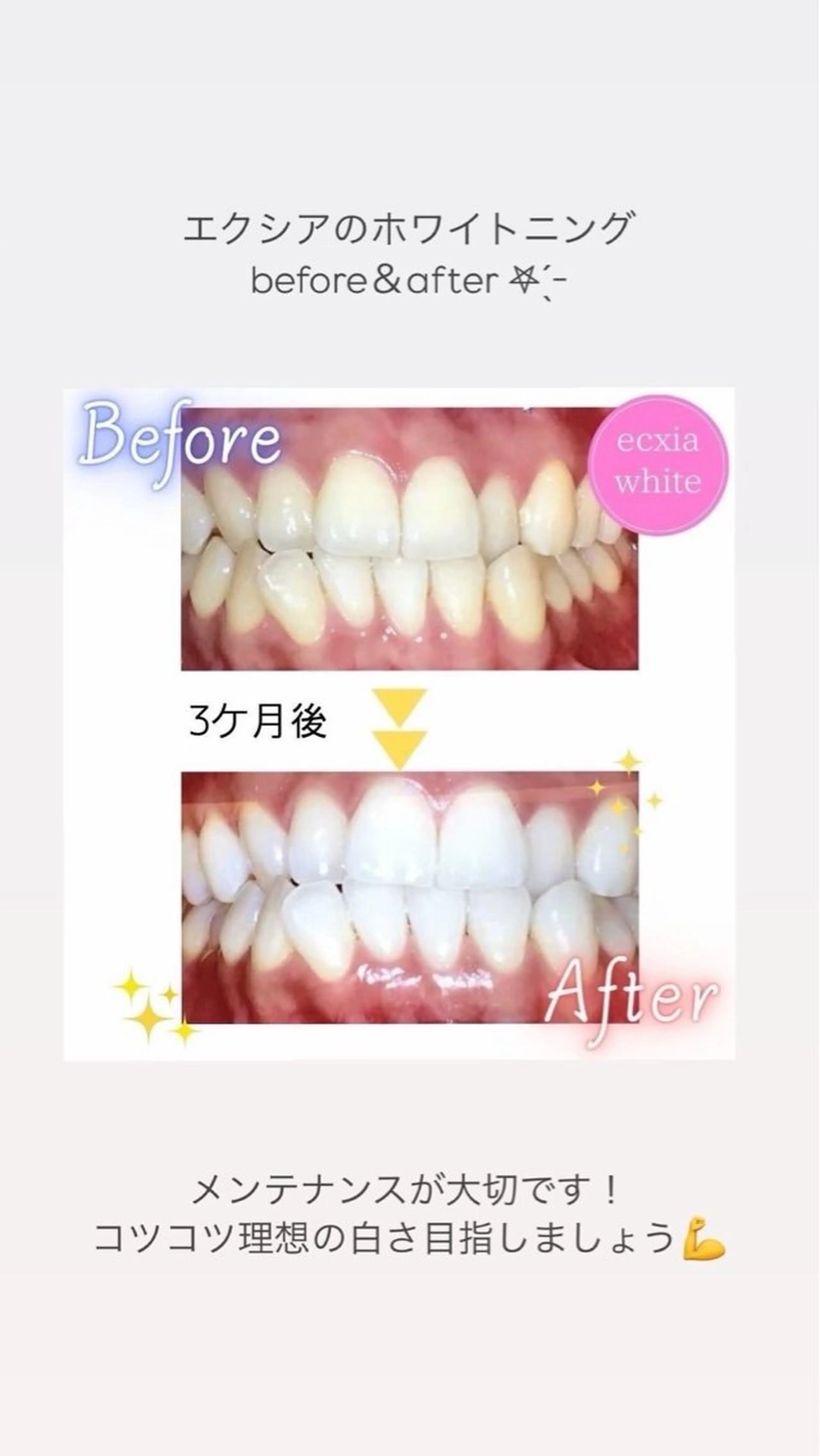 セルフホワイトニング エクシア町田店のその他イメージ