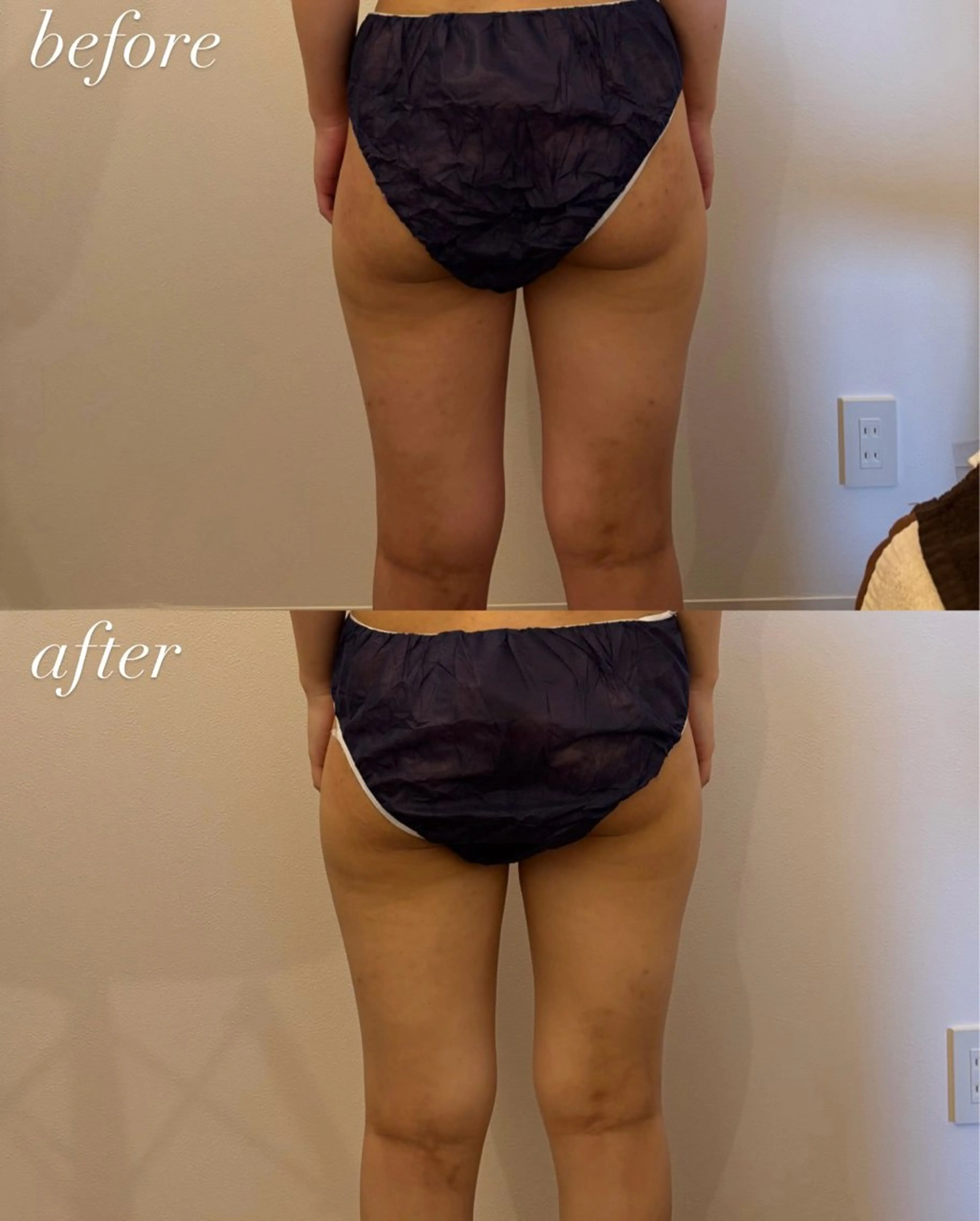 リラク Ellebeauty relaxationのエステ・リラクイメージ