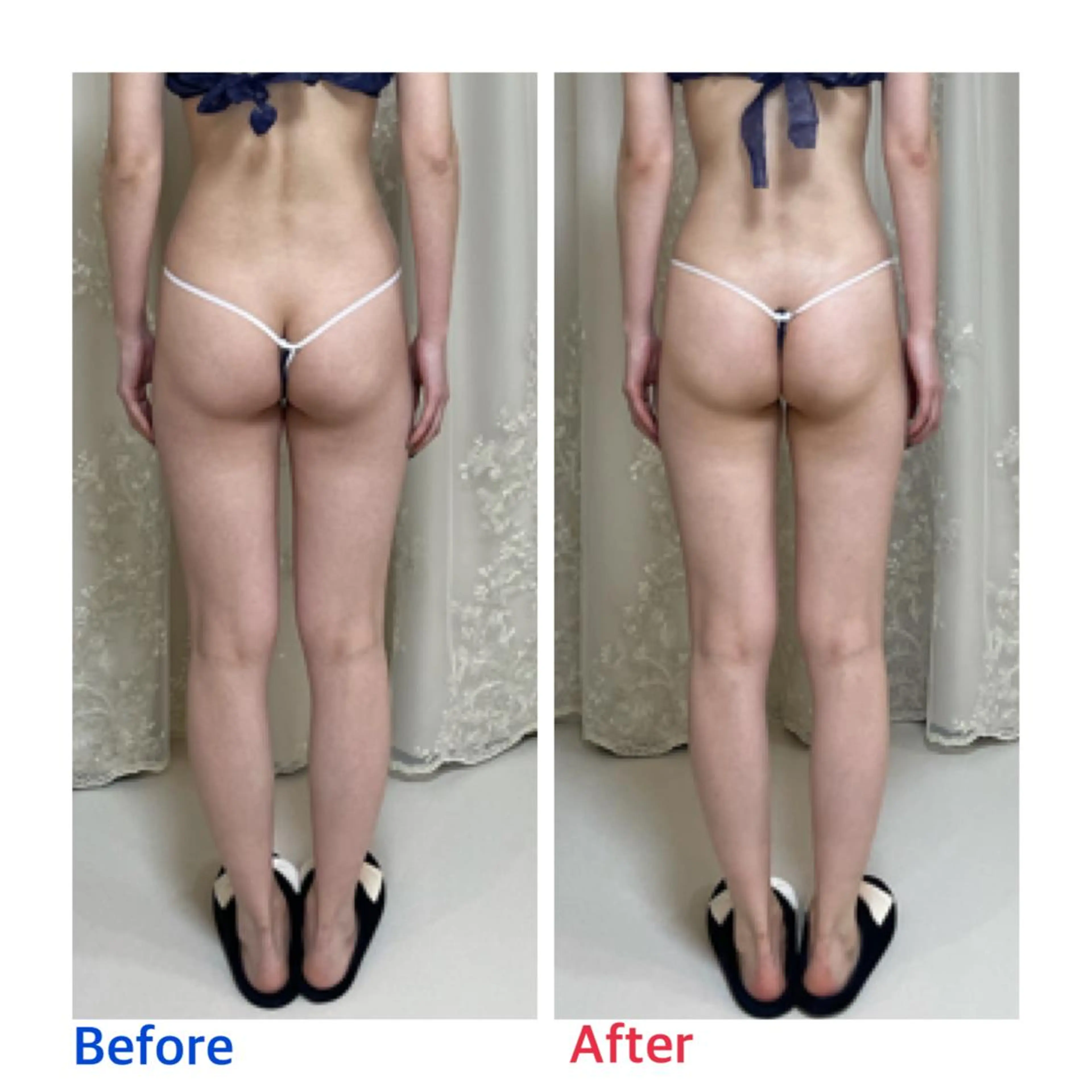 エステ リラク プライベートサロン moyoのエステ・リラクイメージ