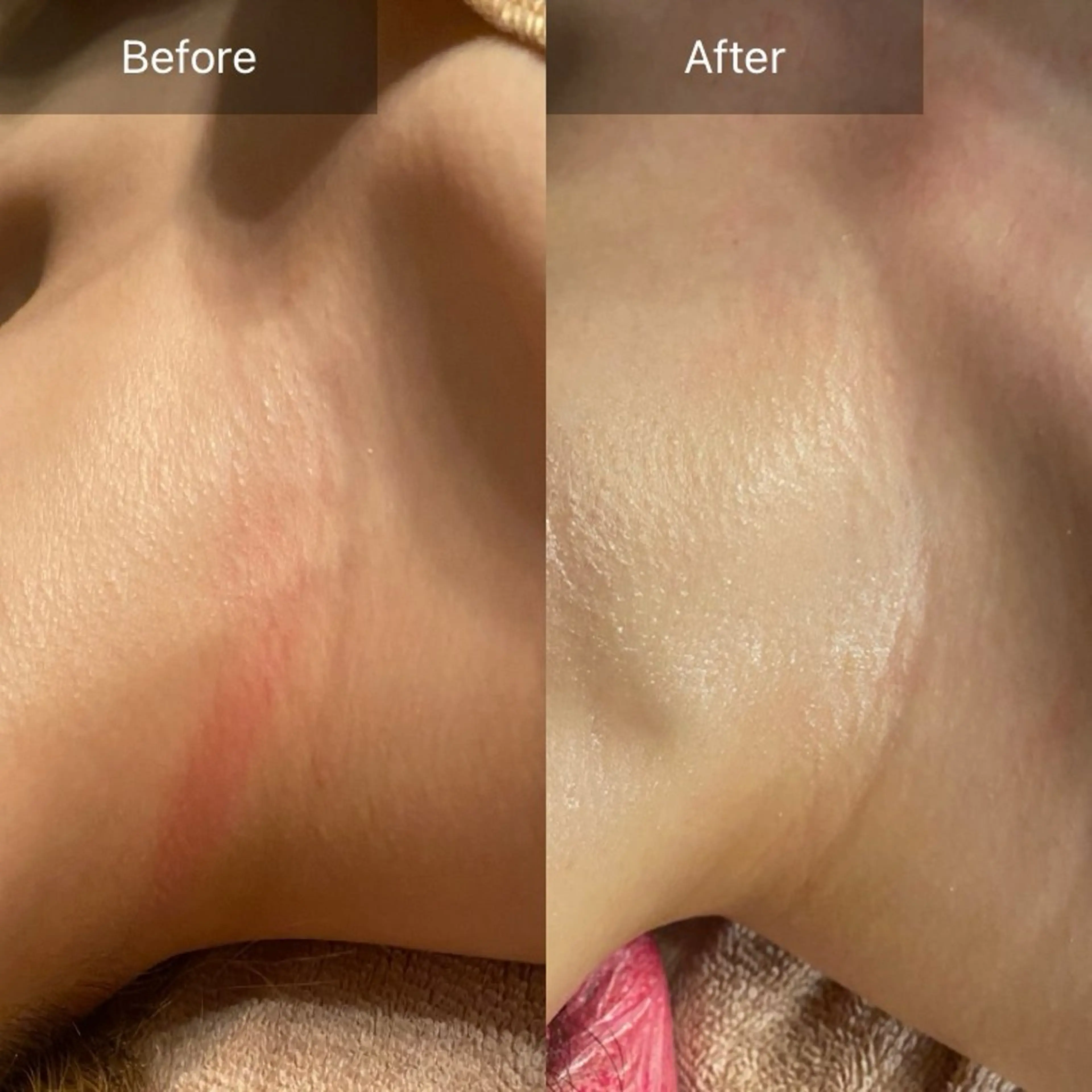 Mandarin Orange所属・毛穴から始める肌メン テマンダリンオレンジのエステ・リラクイメージ