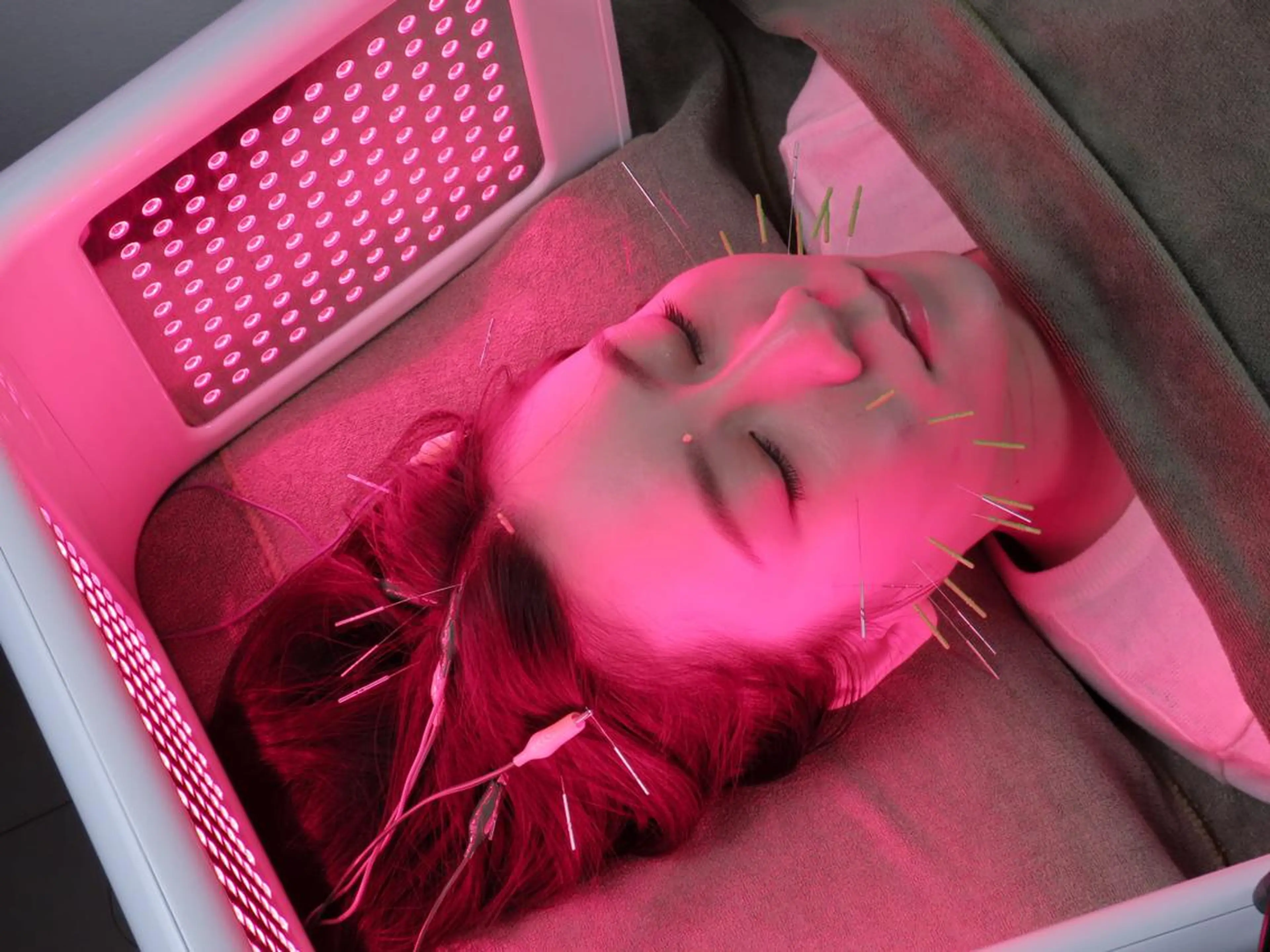 エステ リラク 美容とカラダの鍼灸 サロン やなけんのエステ・リラクイメージ