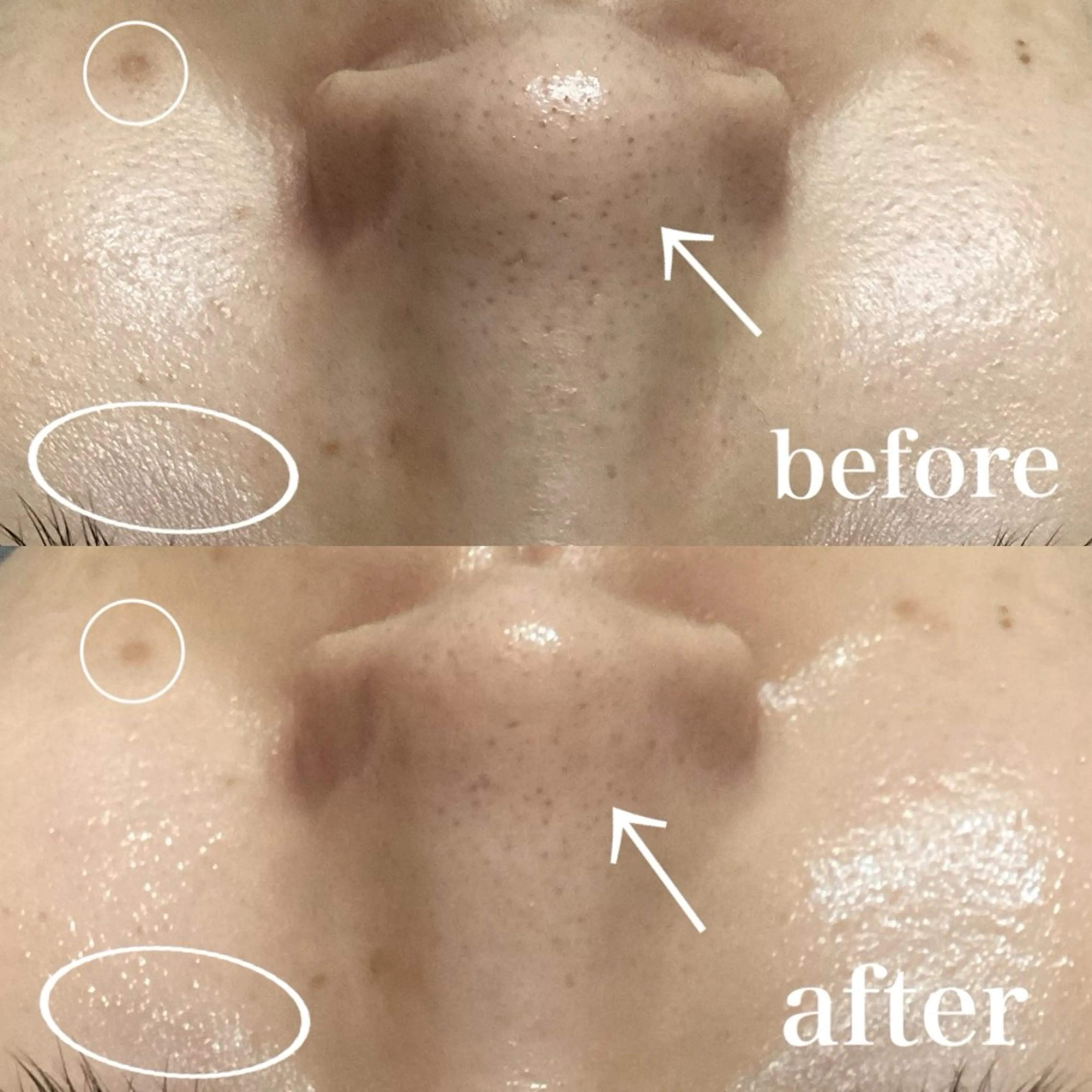 磐田｜LAYLA 一番丁寧な脱毛店のエステ・リラクイメージ