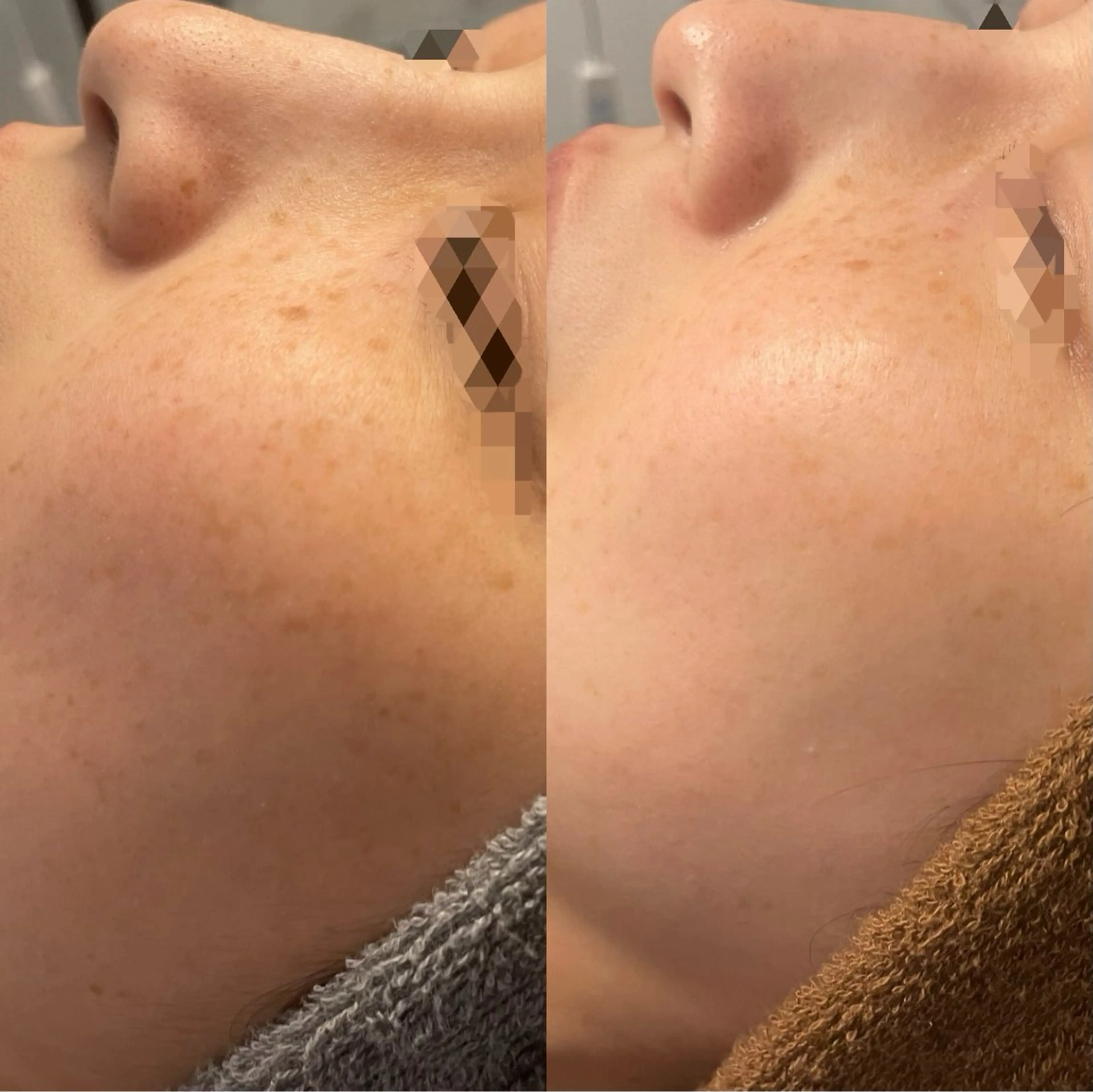 シミケア専門店モルセラ所属・シミケア専門店 モルセラのエステ・リラクイメージ