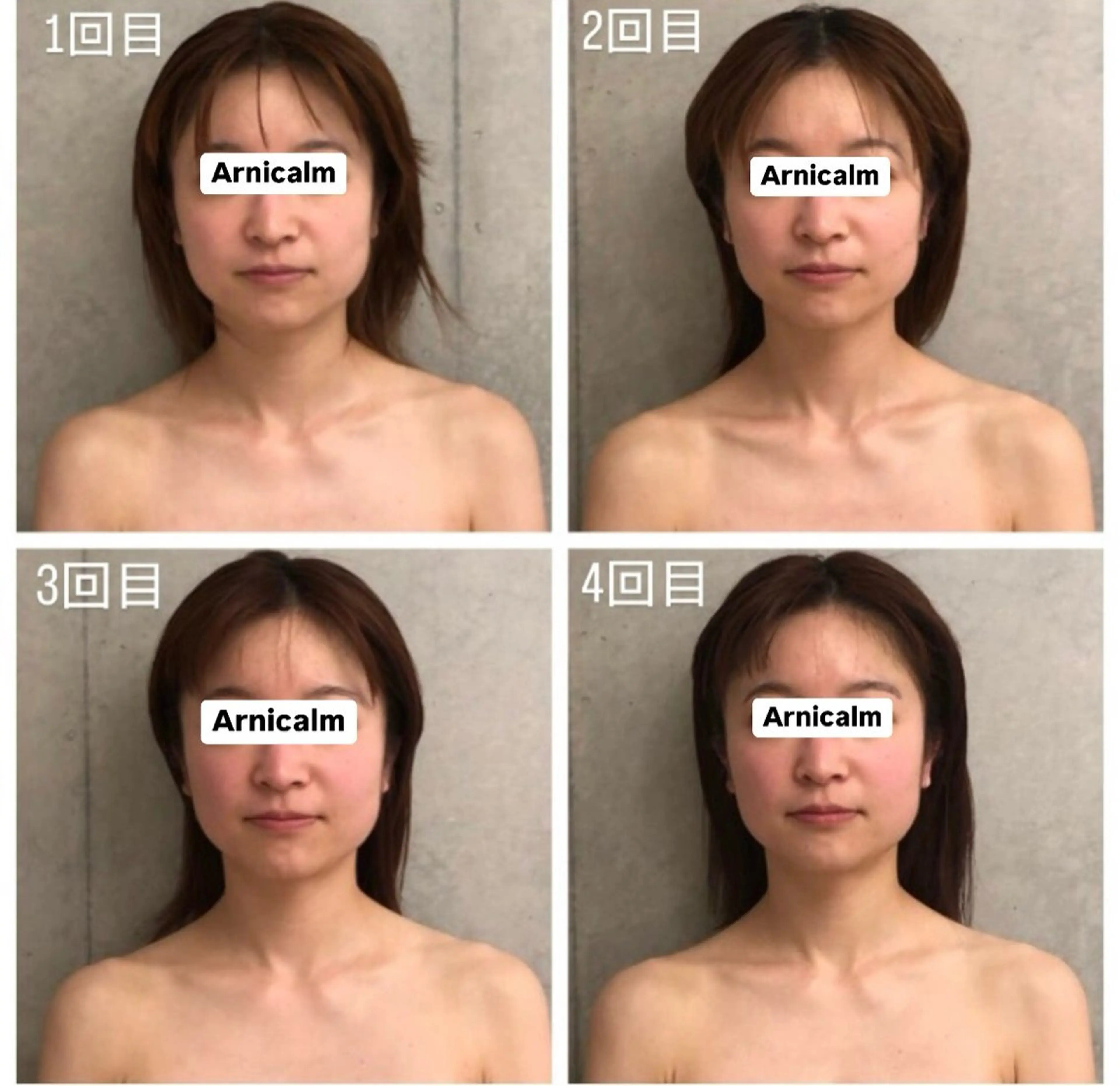 ハーブピーリング 肌再生ピーリング/のエステ・リラクイメージ