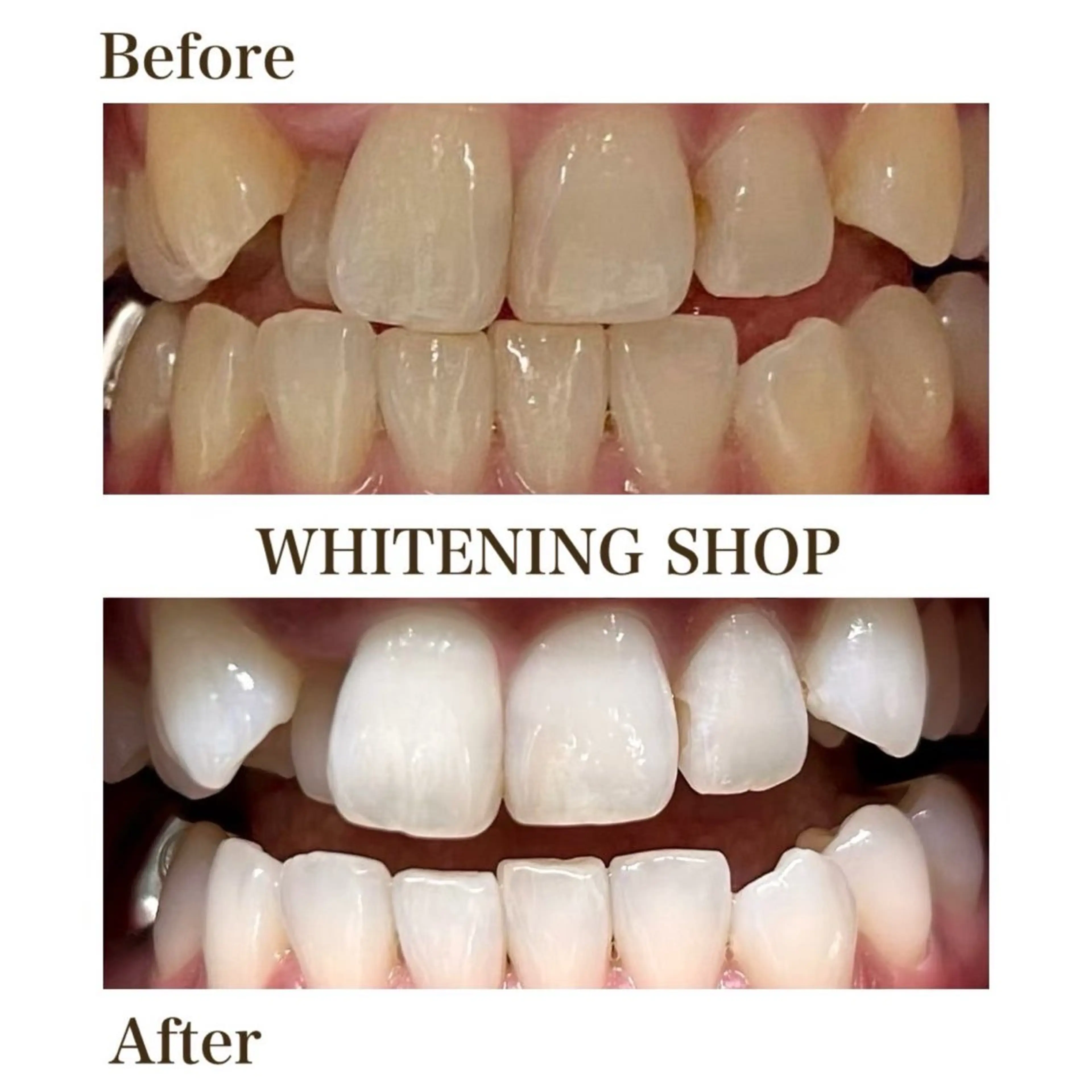 メンズ ホワイトニング ショップ葵区静岡駅店のその他イメージ