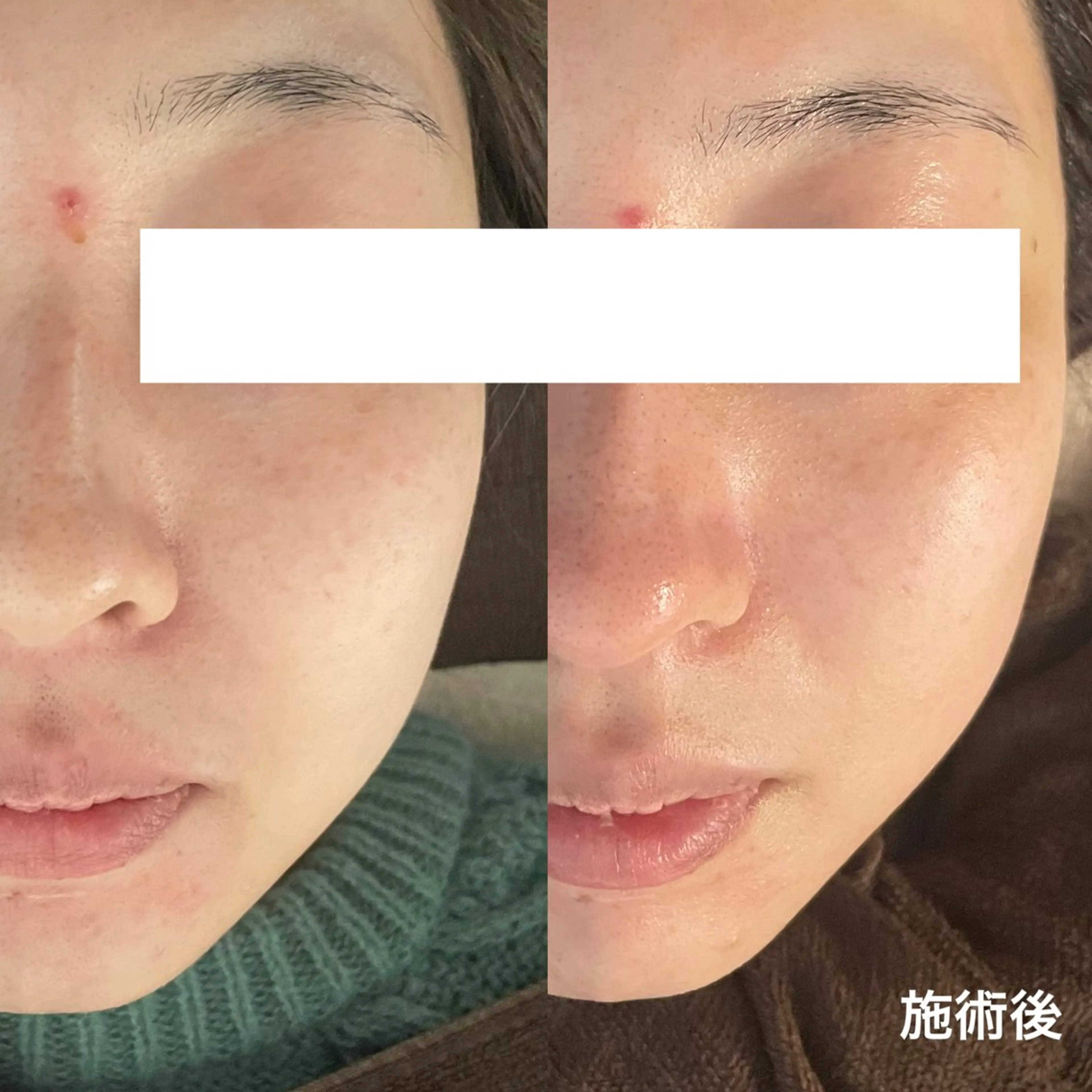 エステ サロンドフルベール 折尾店のエステ・リラクイメージ