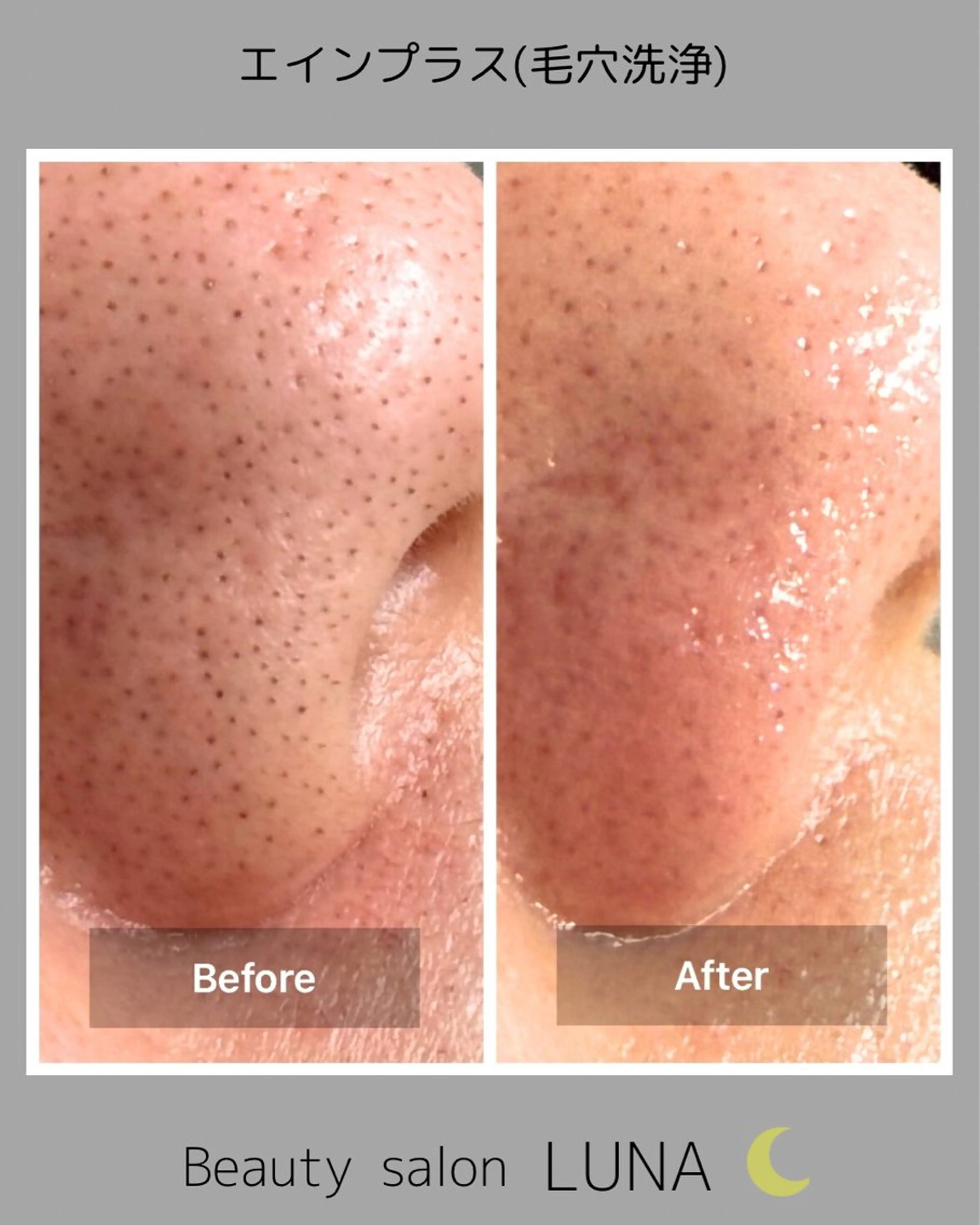 エステ LUNA / Sakikoの眉毛・アイブロウイメージ