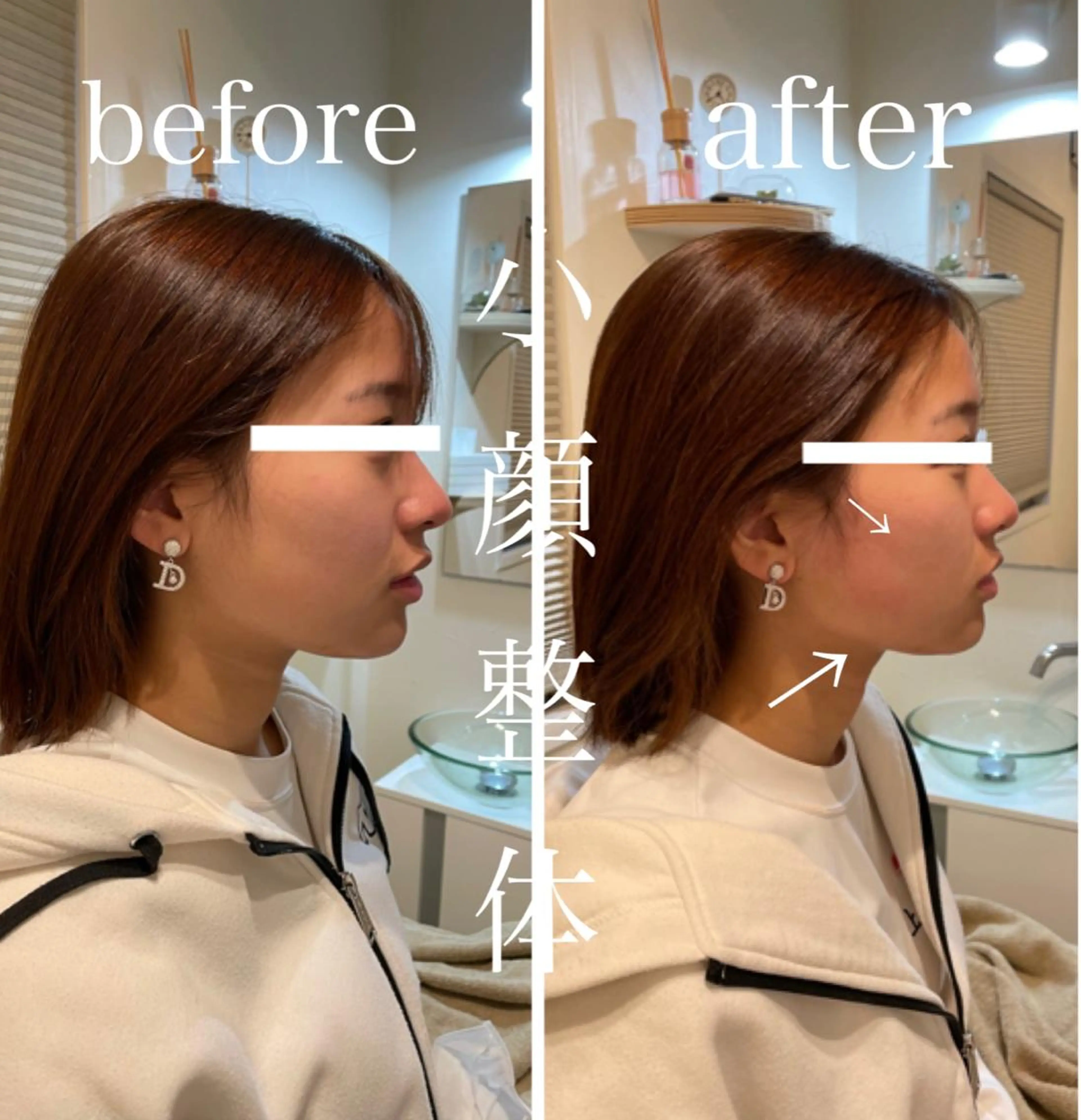 鍼灸 Refineのその他イメージ