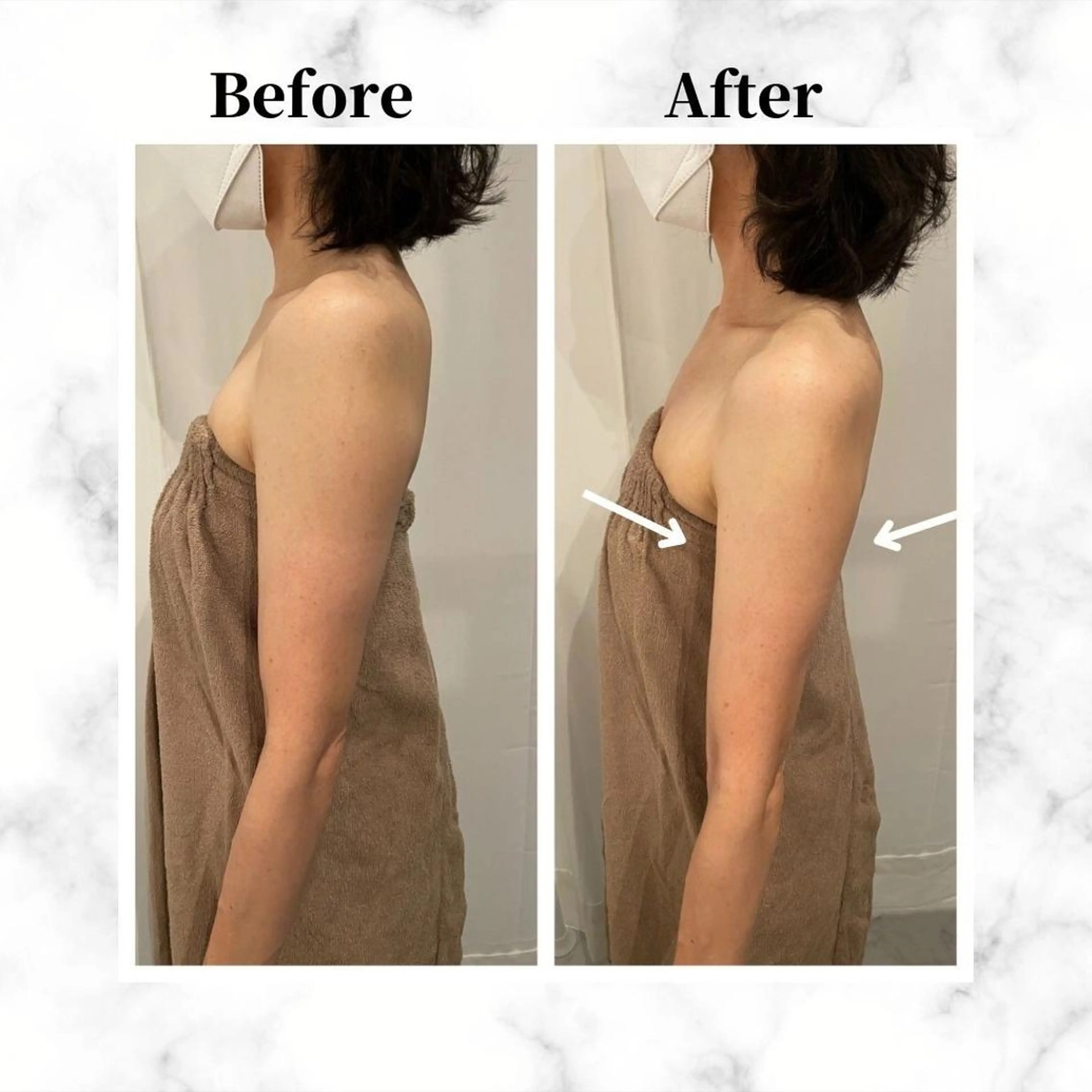 12Dハイフ💗 最強小顔のエステ・リラクイメージ