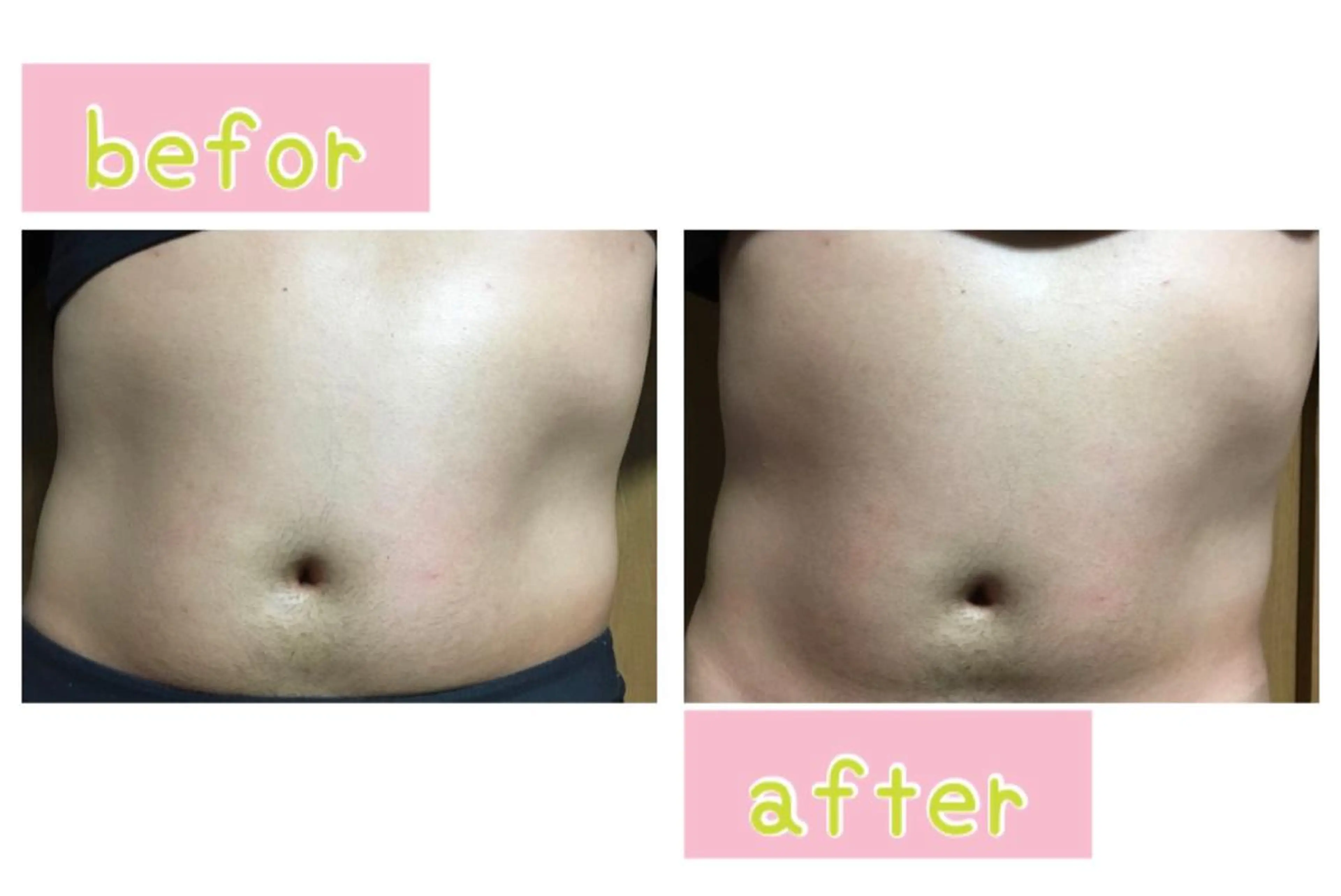 メンズ エステ 癒し腸もみサロン シャユーム　ゆきなのエステ・リラクイメージ