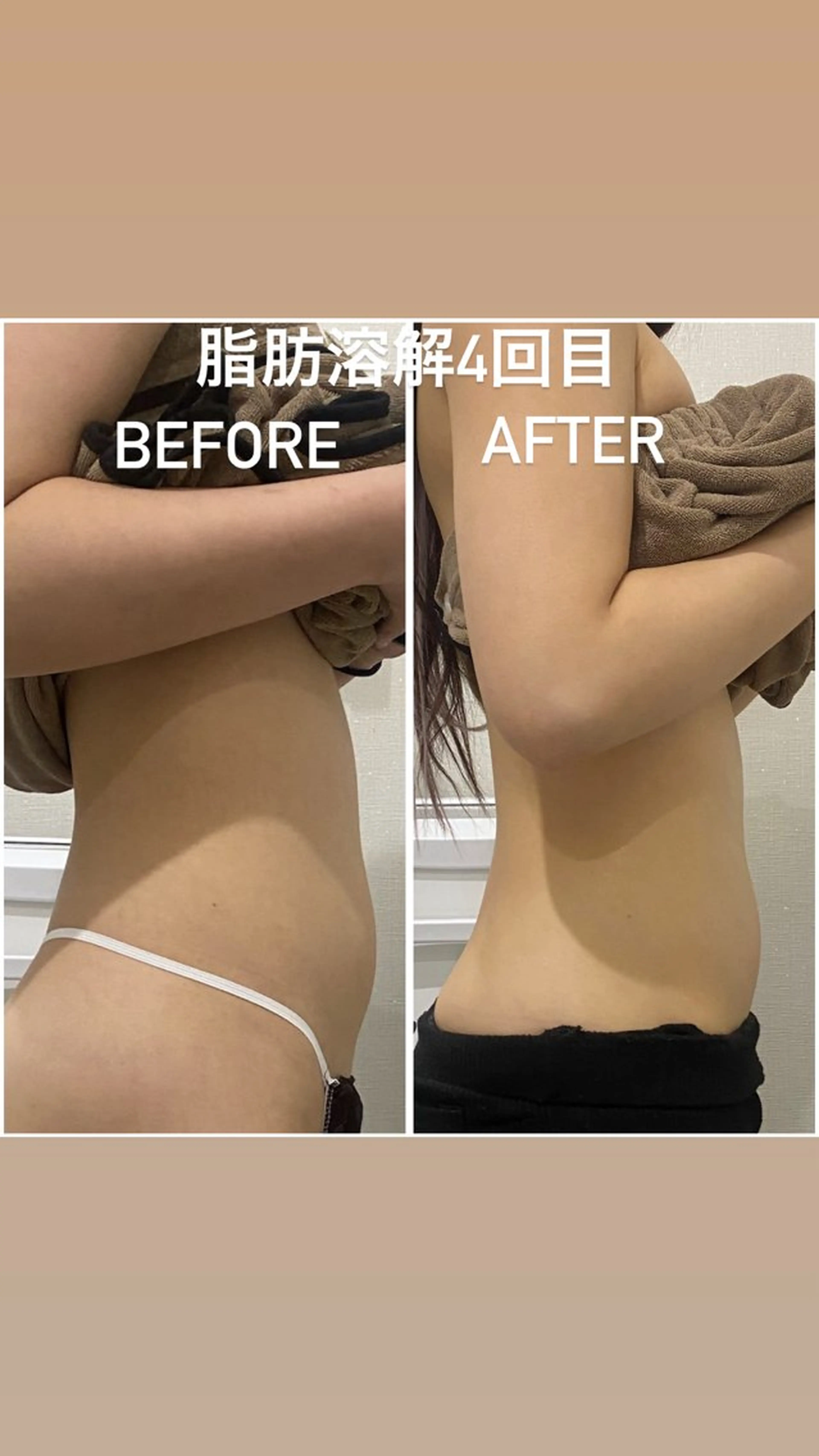 エステ 毛穴洗浄・痩身・脱毛 /アルカンジュのエステ・リラクイメージ