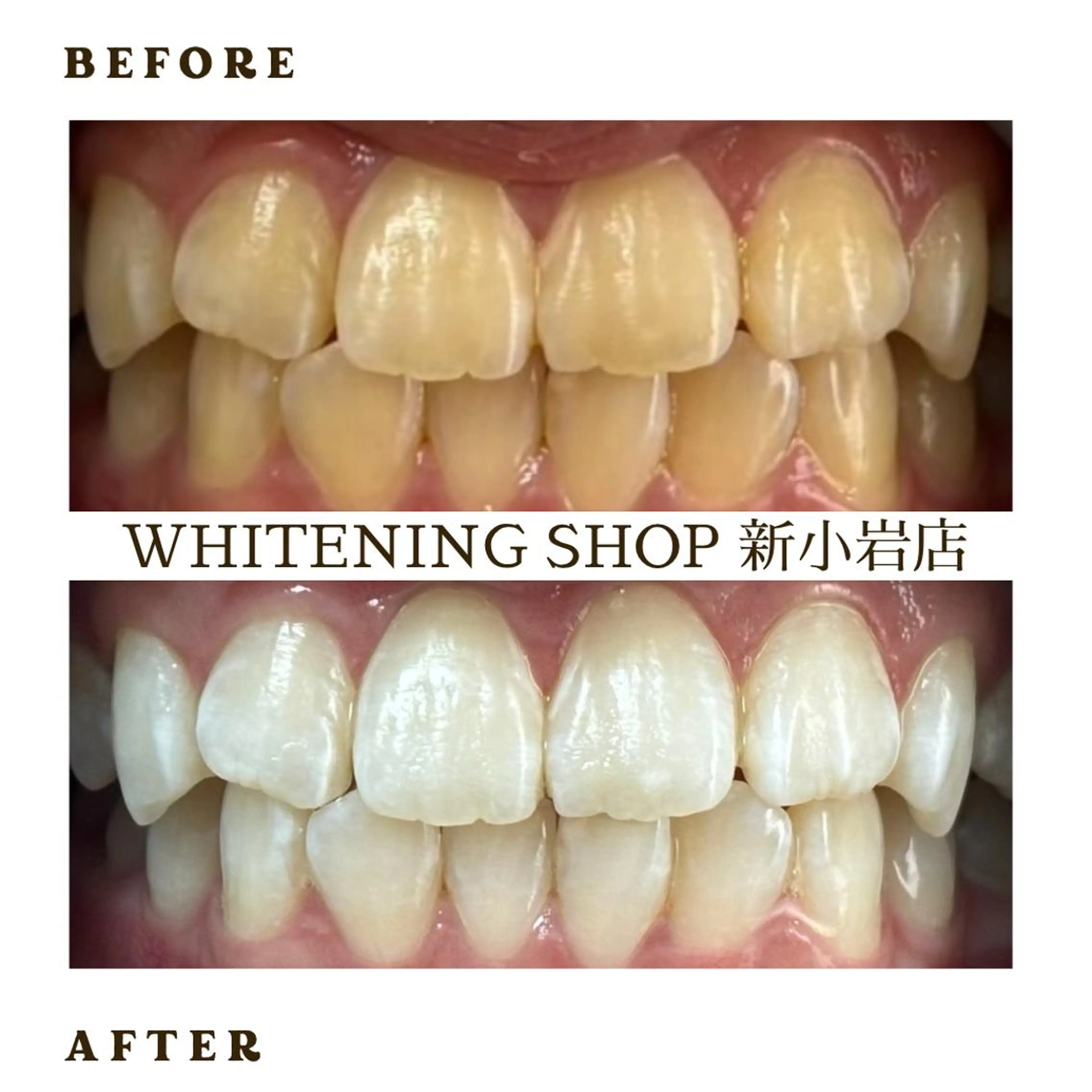 メンズ その他 ホワイトニング ショップ新小岩店のその他イメージ