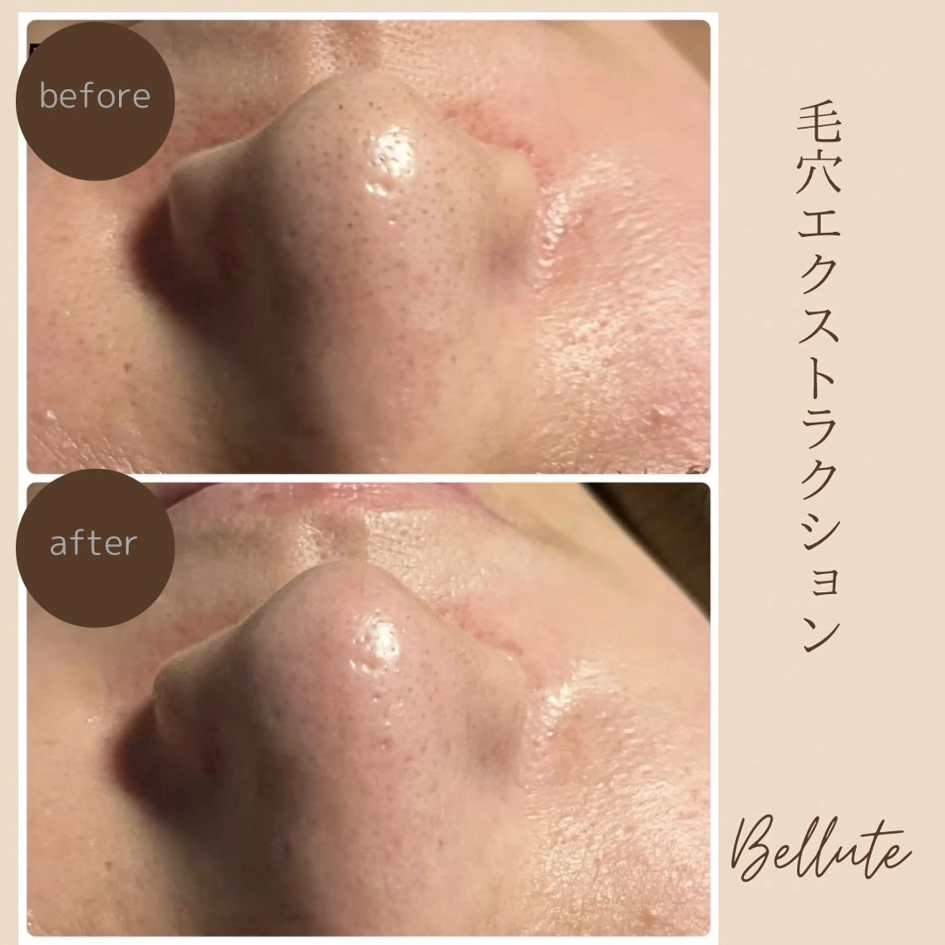 エステ リラク ピーリング専門店 Belluteのエステ・リラクイメージ