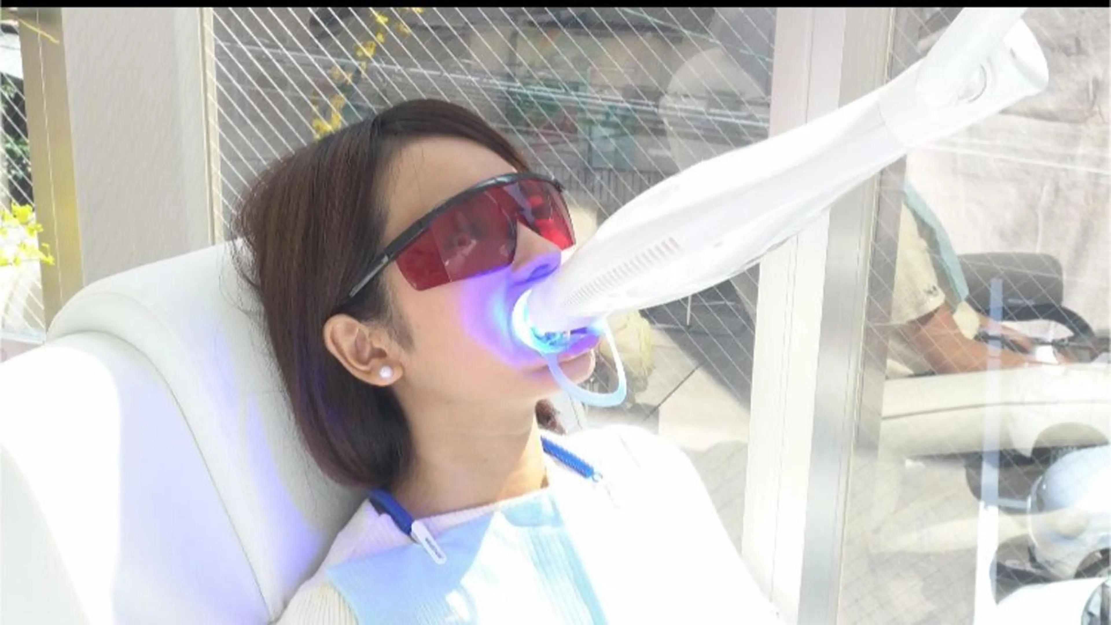 🈹セルフホワイトニング🌈初回¥1980円の写真