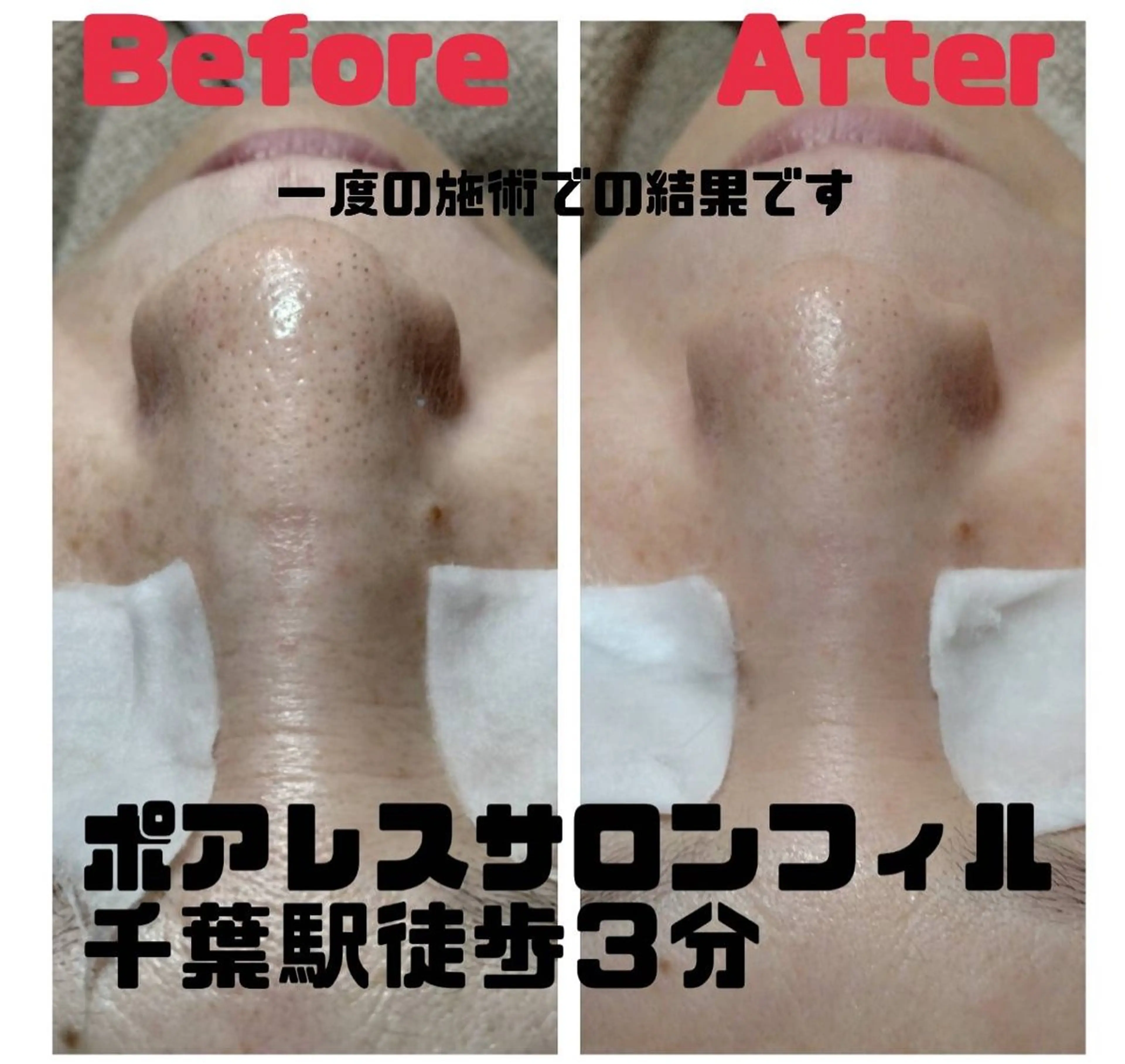 ポアレスサロン フィルのエステ・リラクイメージ