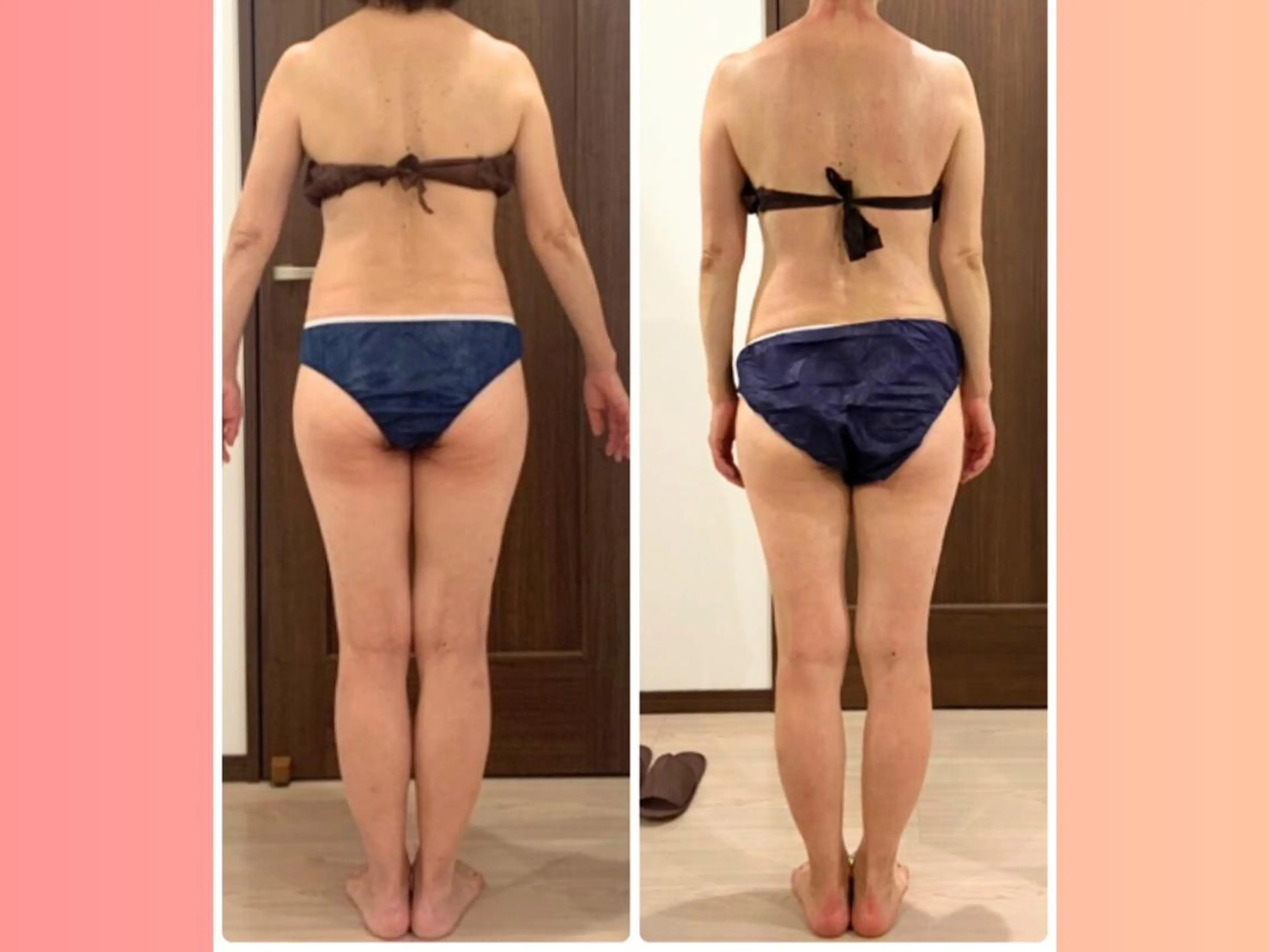 痩身&小顔矯正専門店 Re:Livesのエステ・リラクイメージ