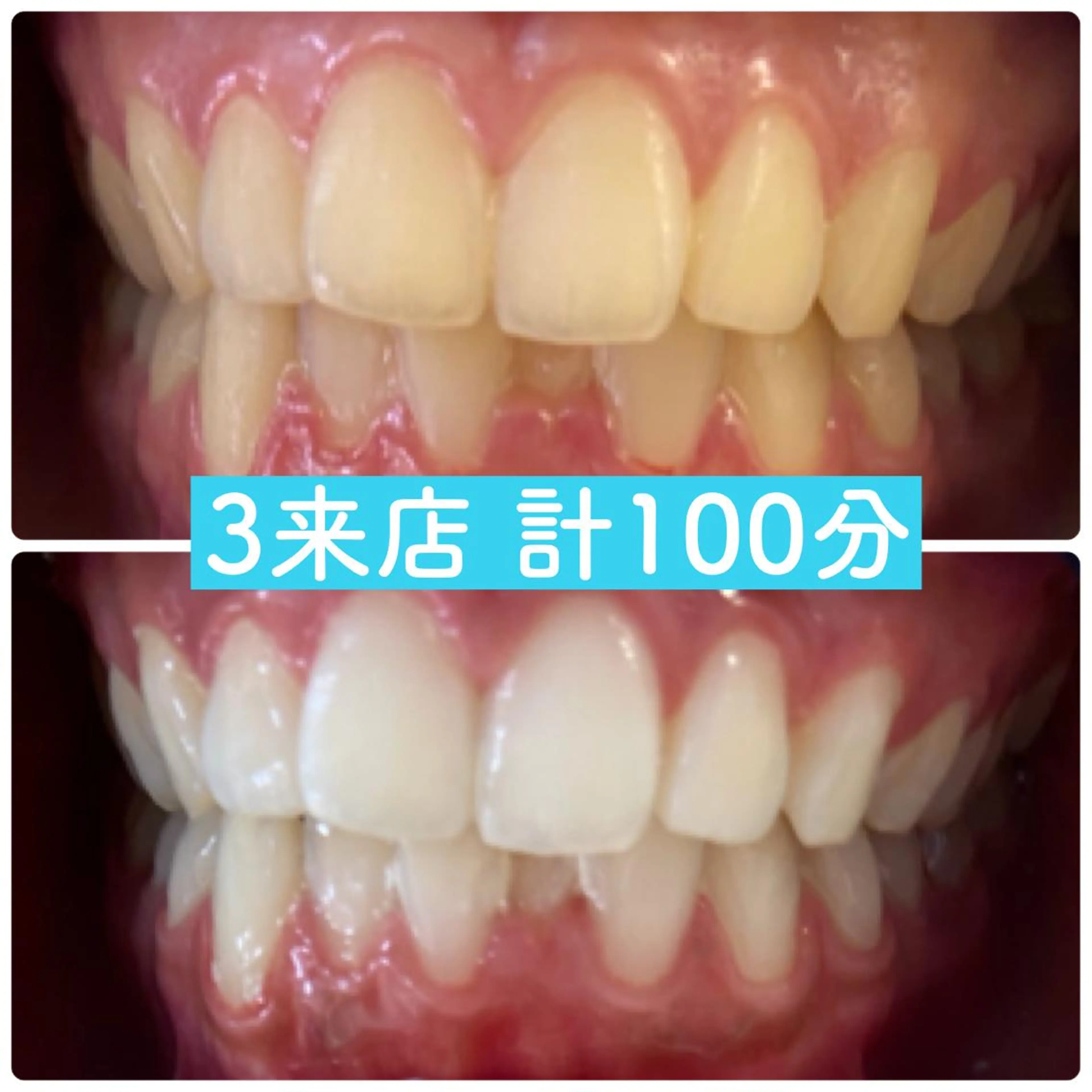 ホワイトニングルーム 横浜店のその他イメージ