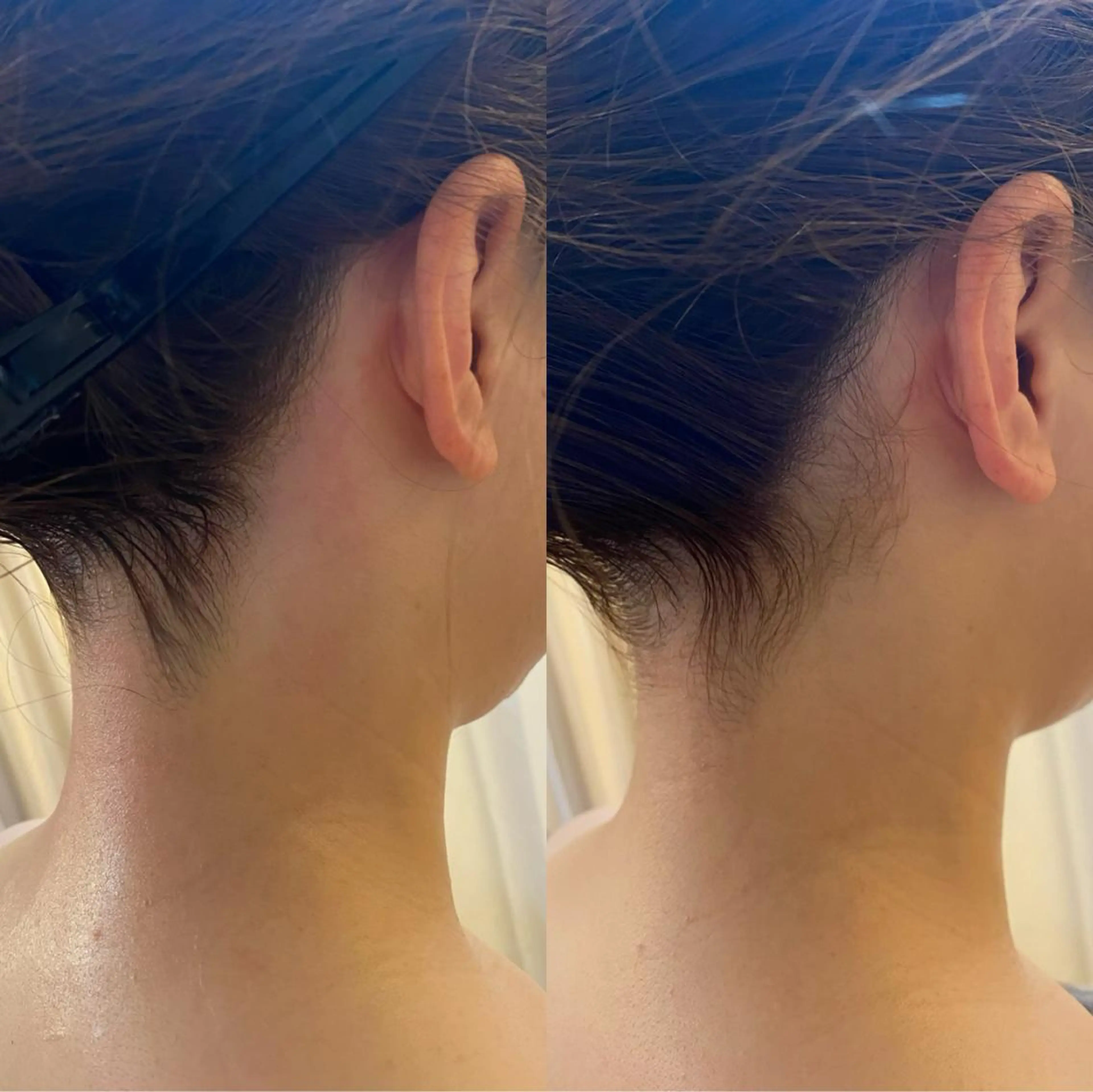 脱毛 BELCIA福岡店 レコルトデベルシアのエステ・リラクイメージ