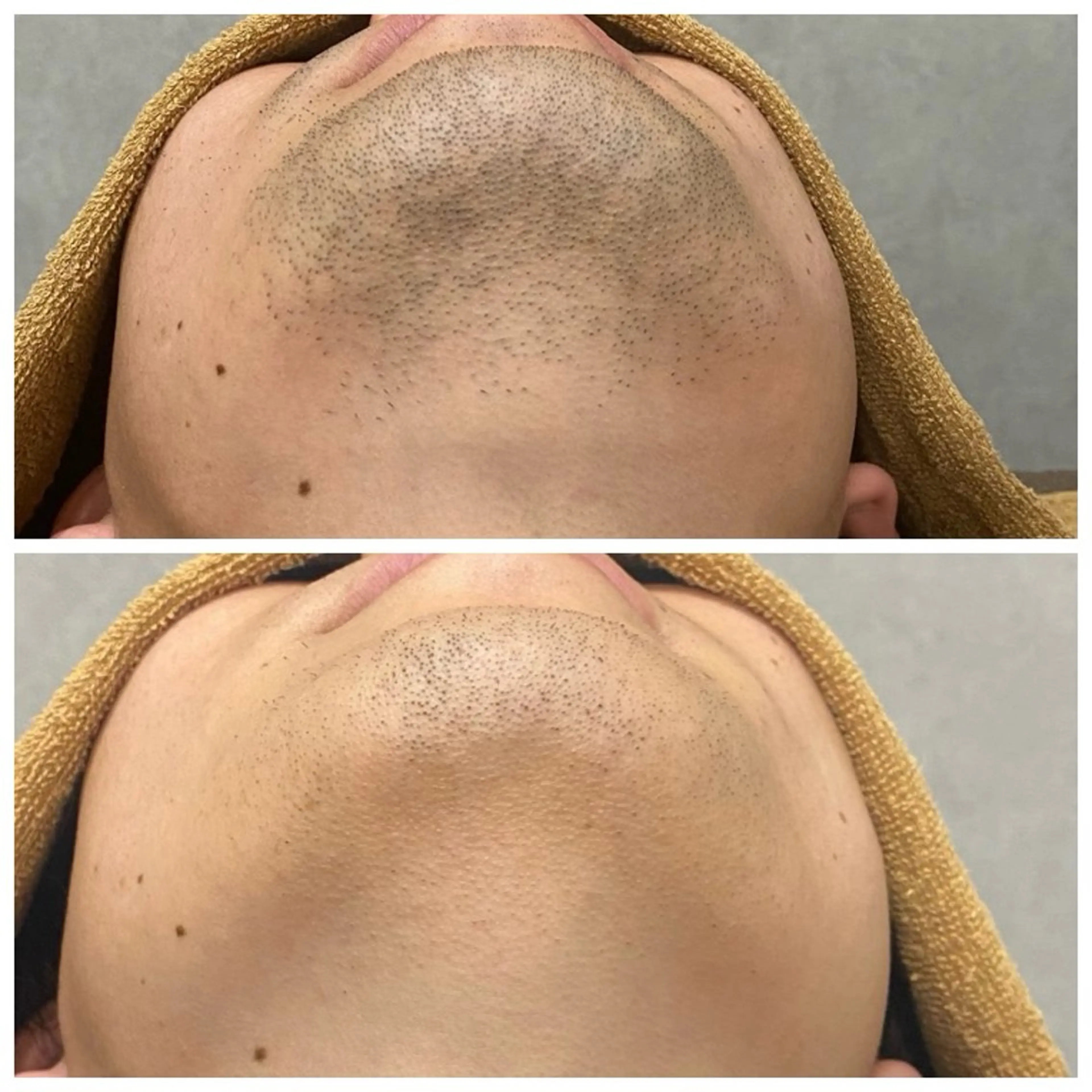 メンズ いしざわ /メンズ脱毛サロンのエステ・リラクイメージ