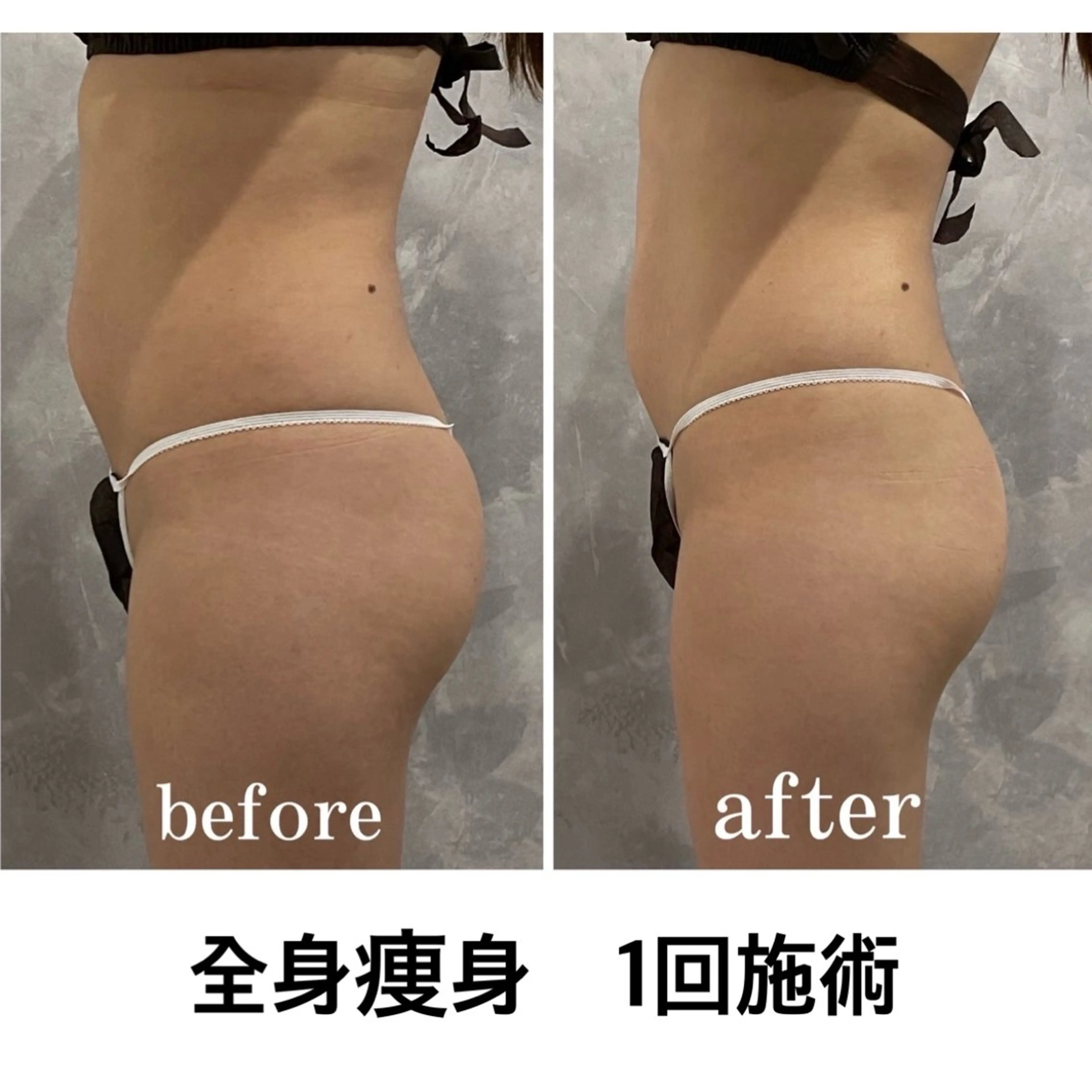 林 陽向のエステ・リラクイメージ