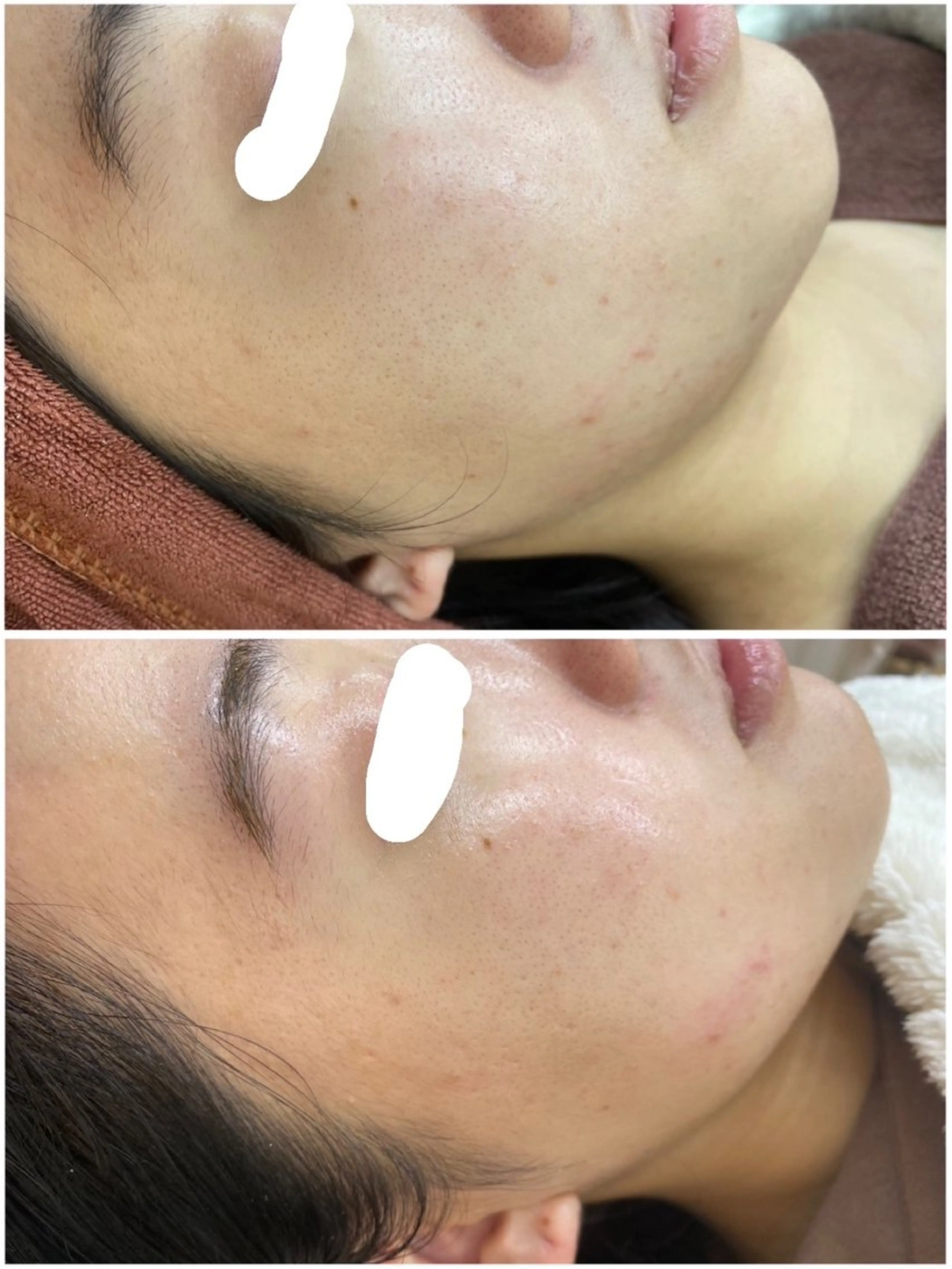 肌質改善ワックス専門 yukiのエステ・リラクイメージ