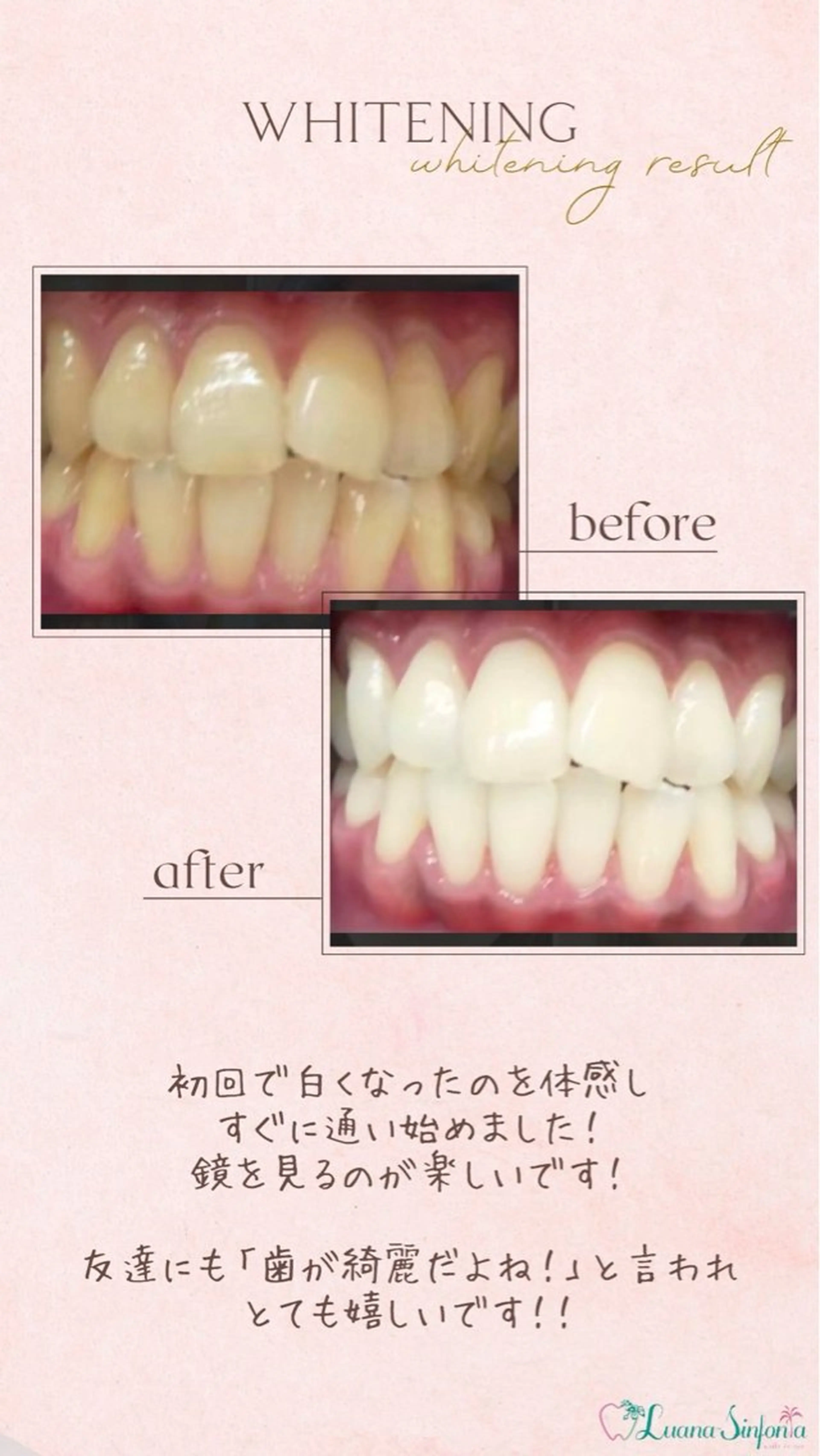 橋口 花菜子のその他イメージ