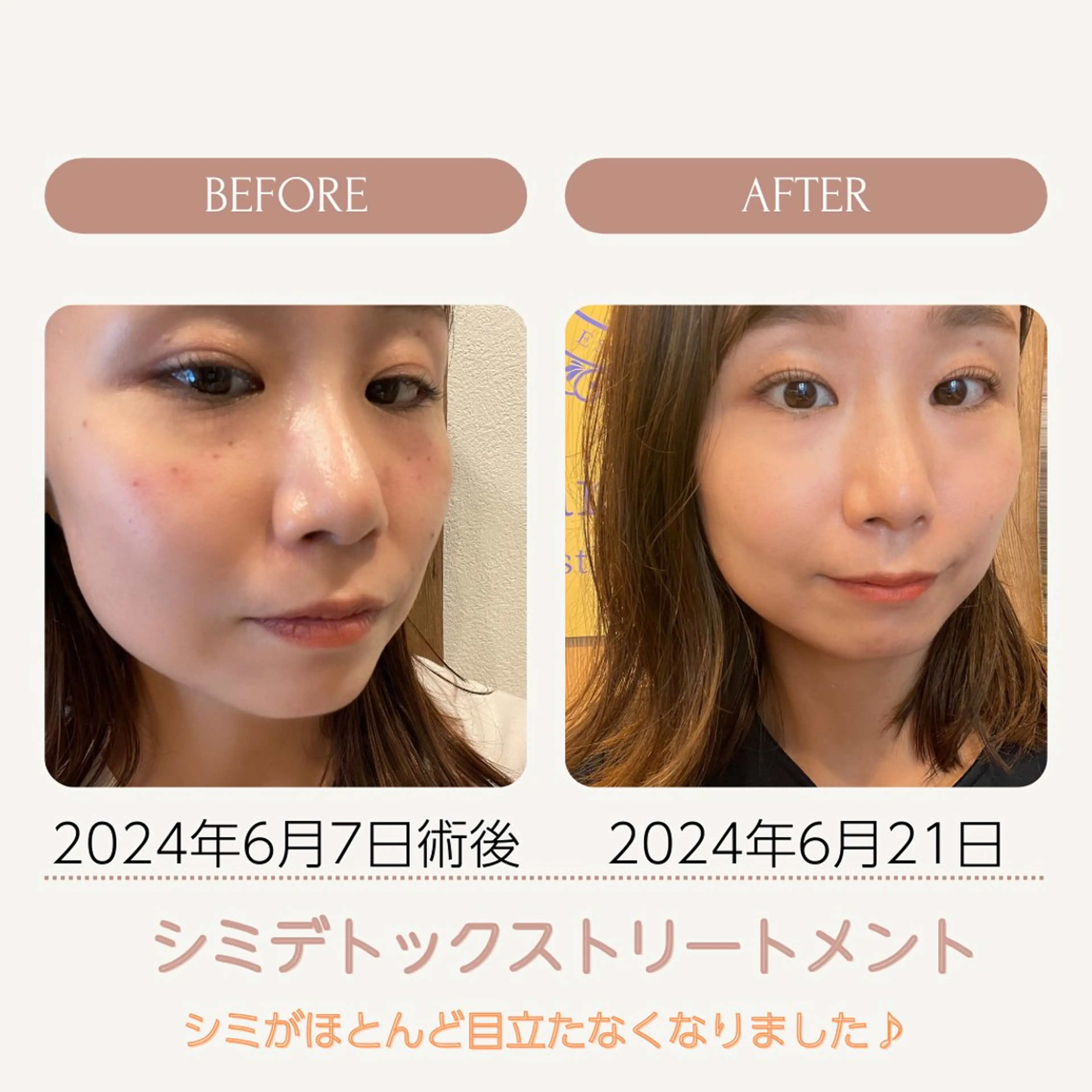 エステ vary  clue MISAのその他イメージ