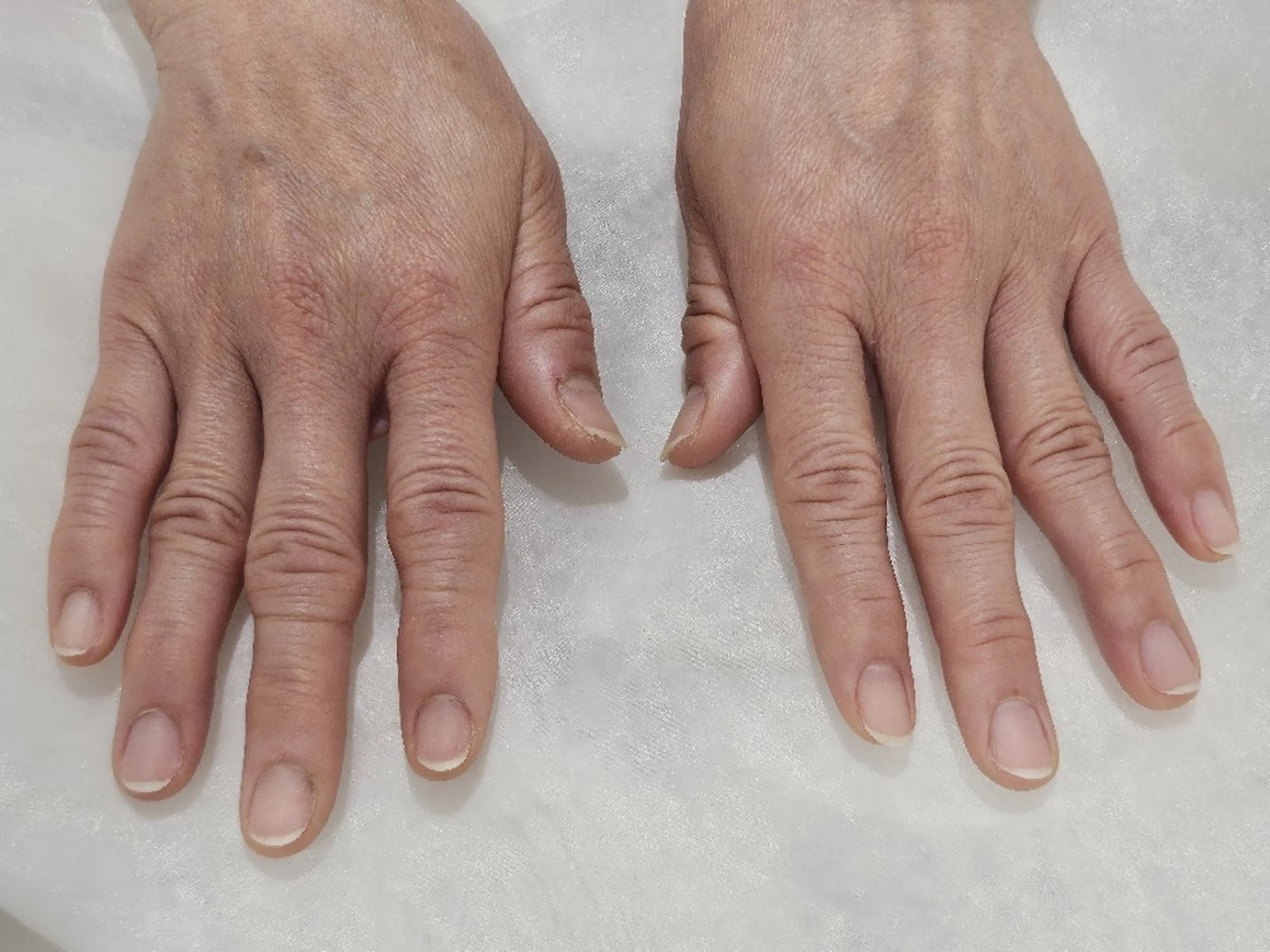 ネイル オフのみ(ネイル) Murakami Akaneのネイルデザイン