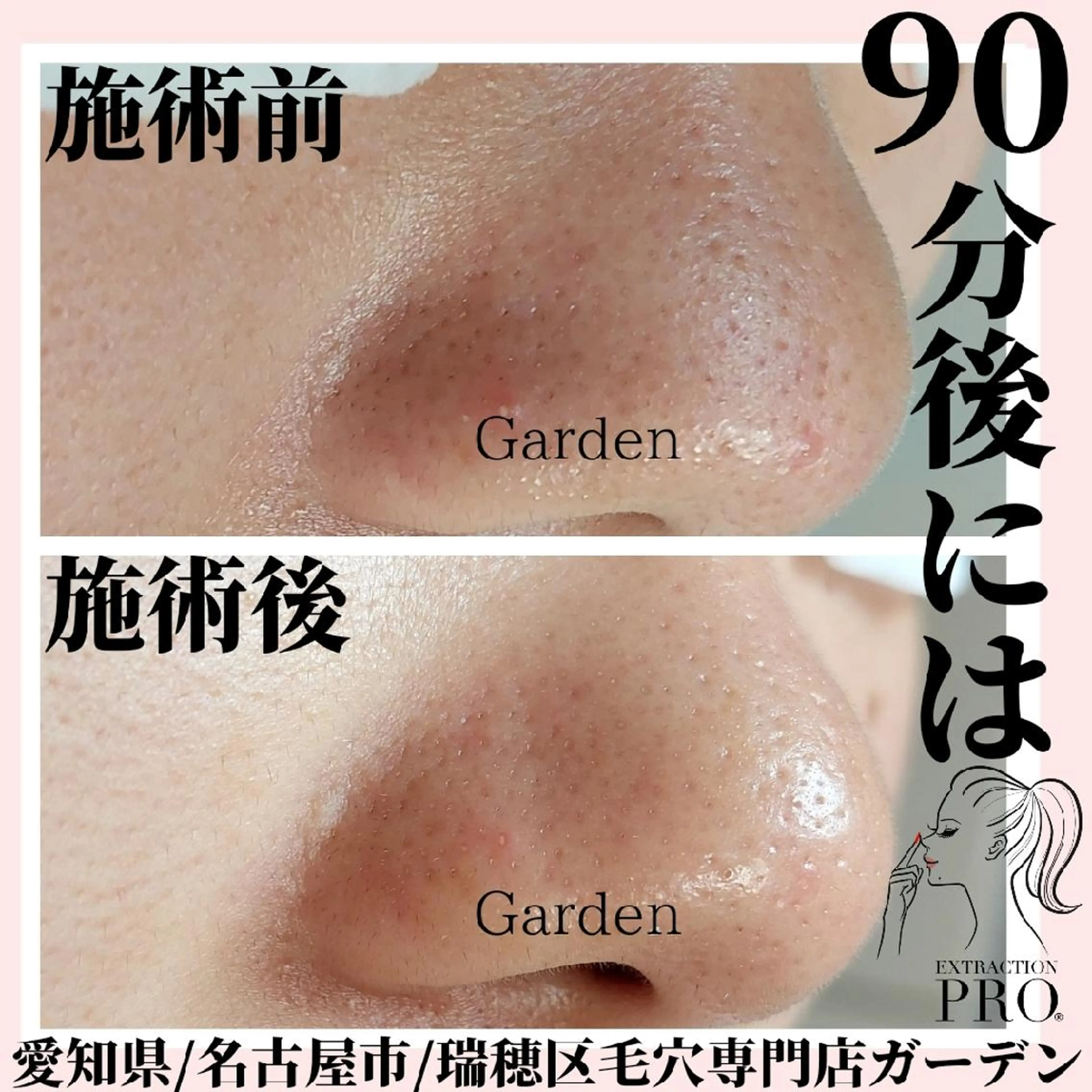 プライベートサロン Gardenのエステ・リラクイメージ