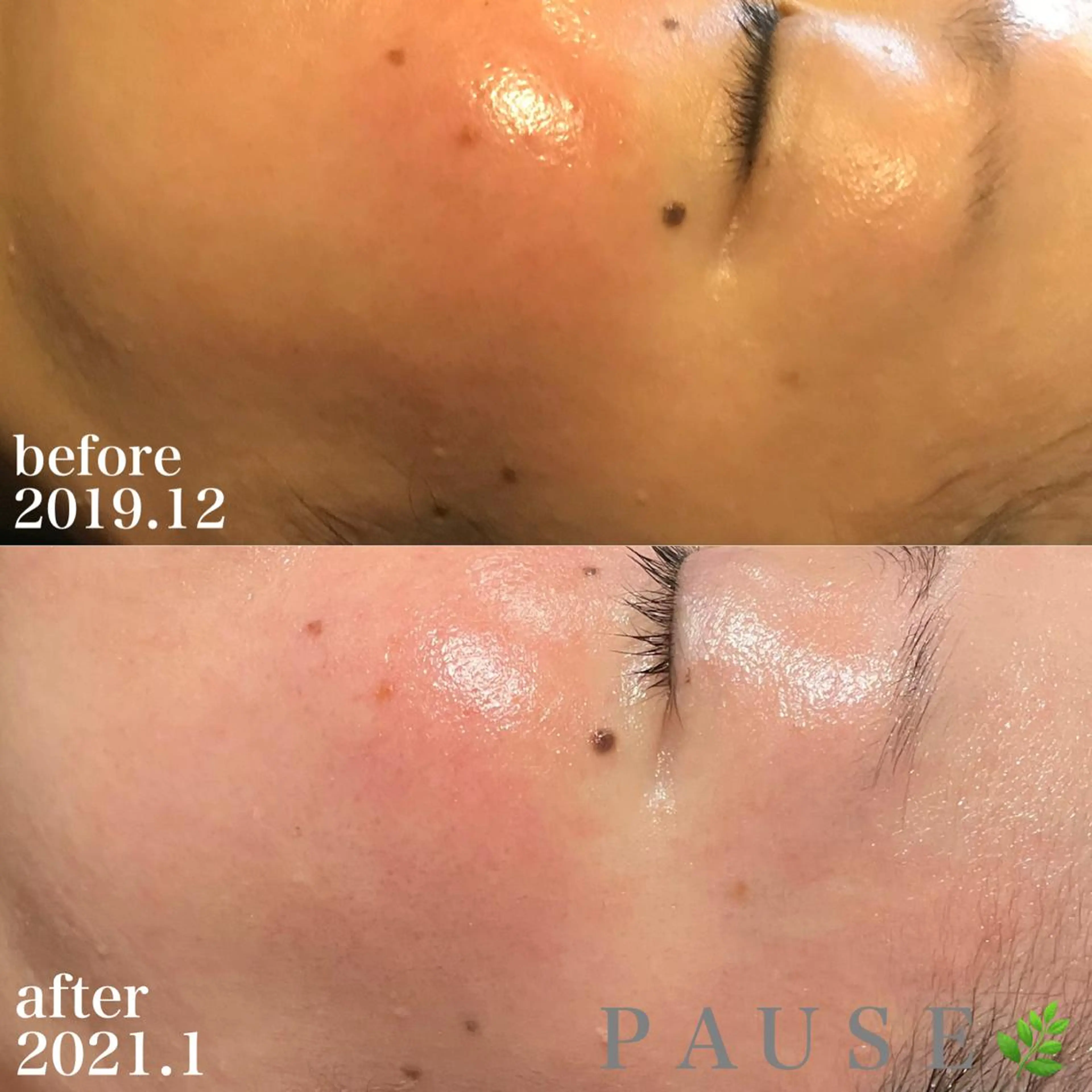 エステ リラク 浜野 恵美のエステ・リラクイメージ